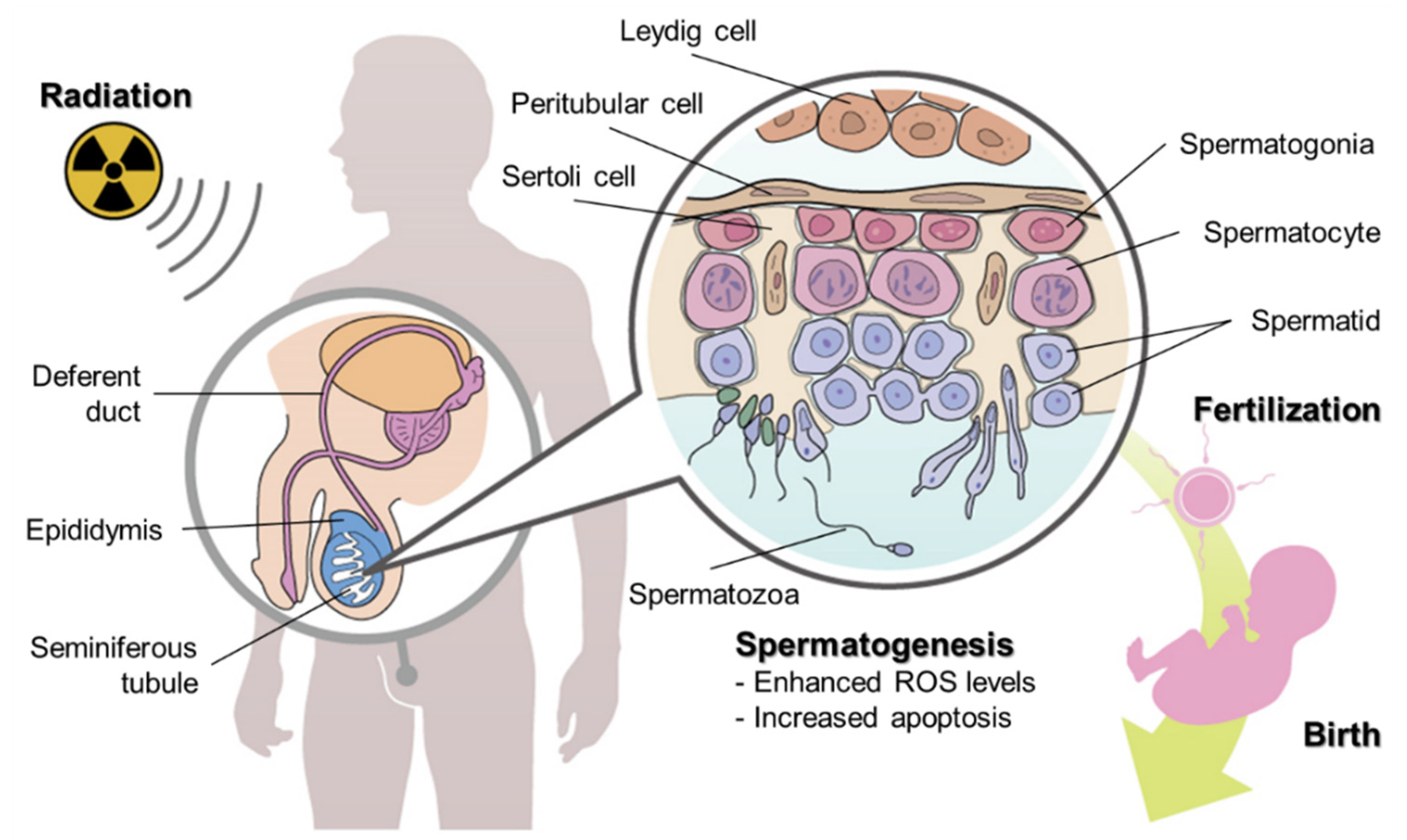 Annihilate militia doorway Cancers | Free Full-Text | A Brief Overview of Radiation-Induced Effects on Spermatogenesis and Oncofertility Annihilate militia doorway Cancers | Free Full-Text | A Brief Overview of Radiation-Induced Effects on Spermatogenesis and Oncofertility