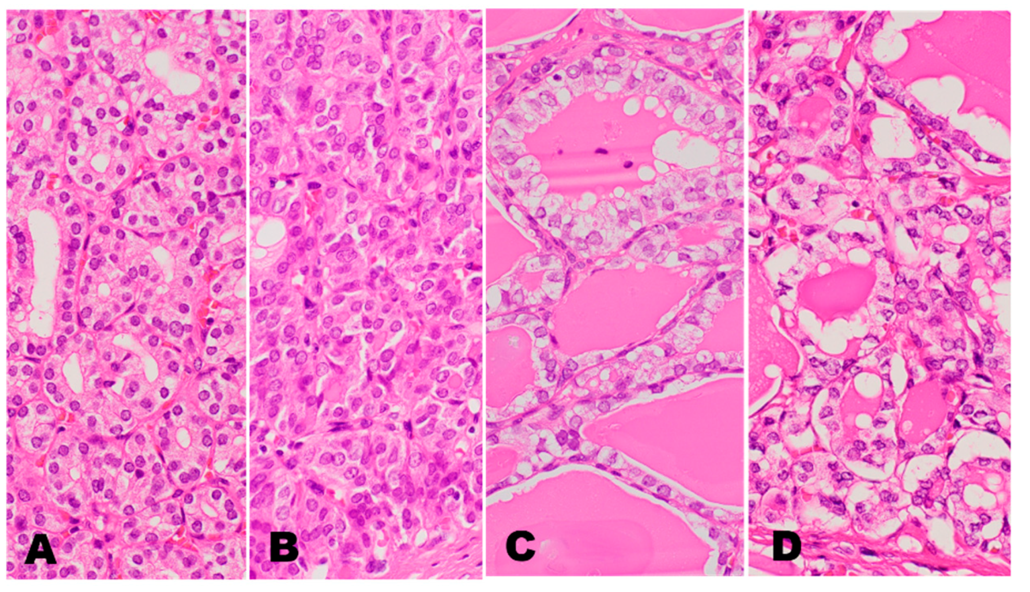 Cancers 14 00812 g001 Cancers 14 00812 g001