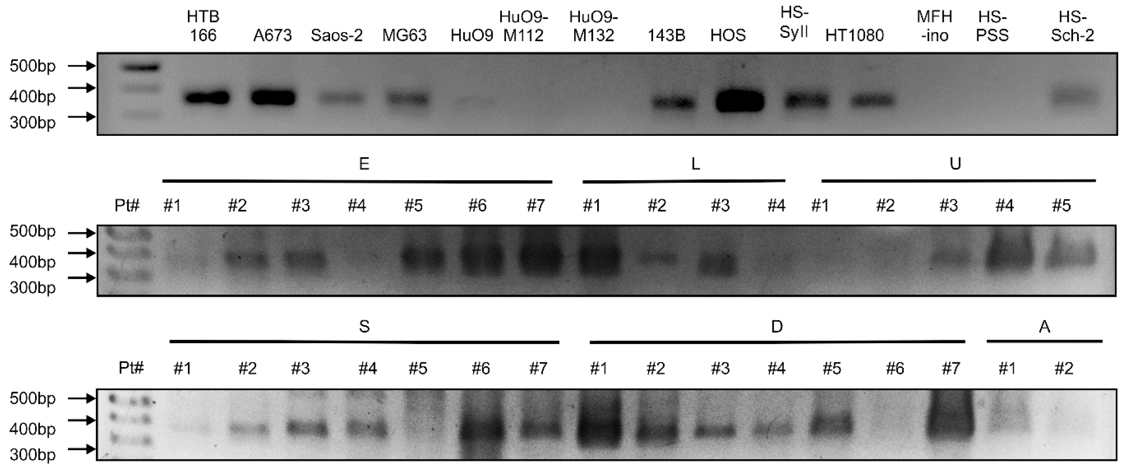 Cancers 14 00814 g004