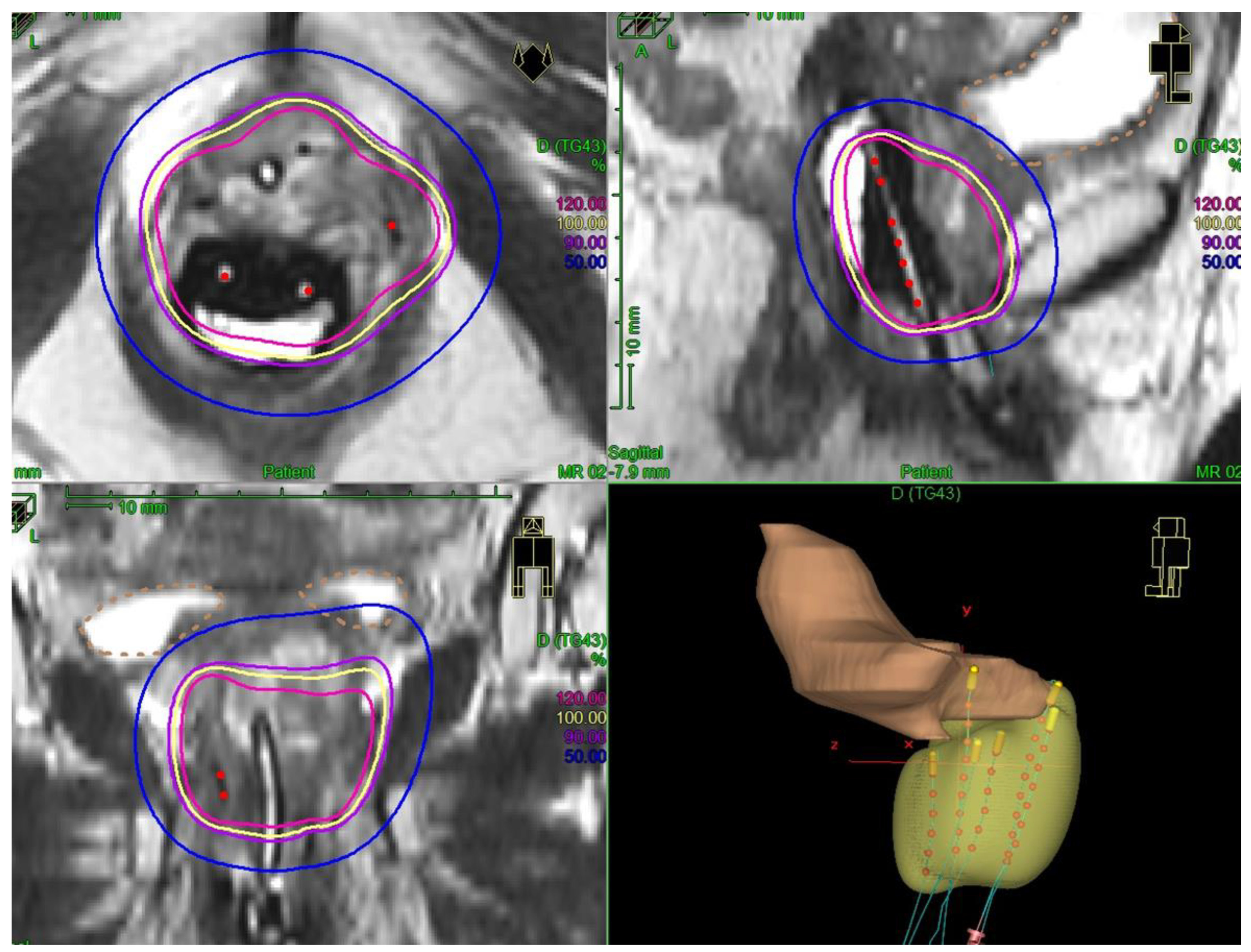 Cancers 14 00845 g001 550