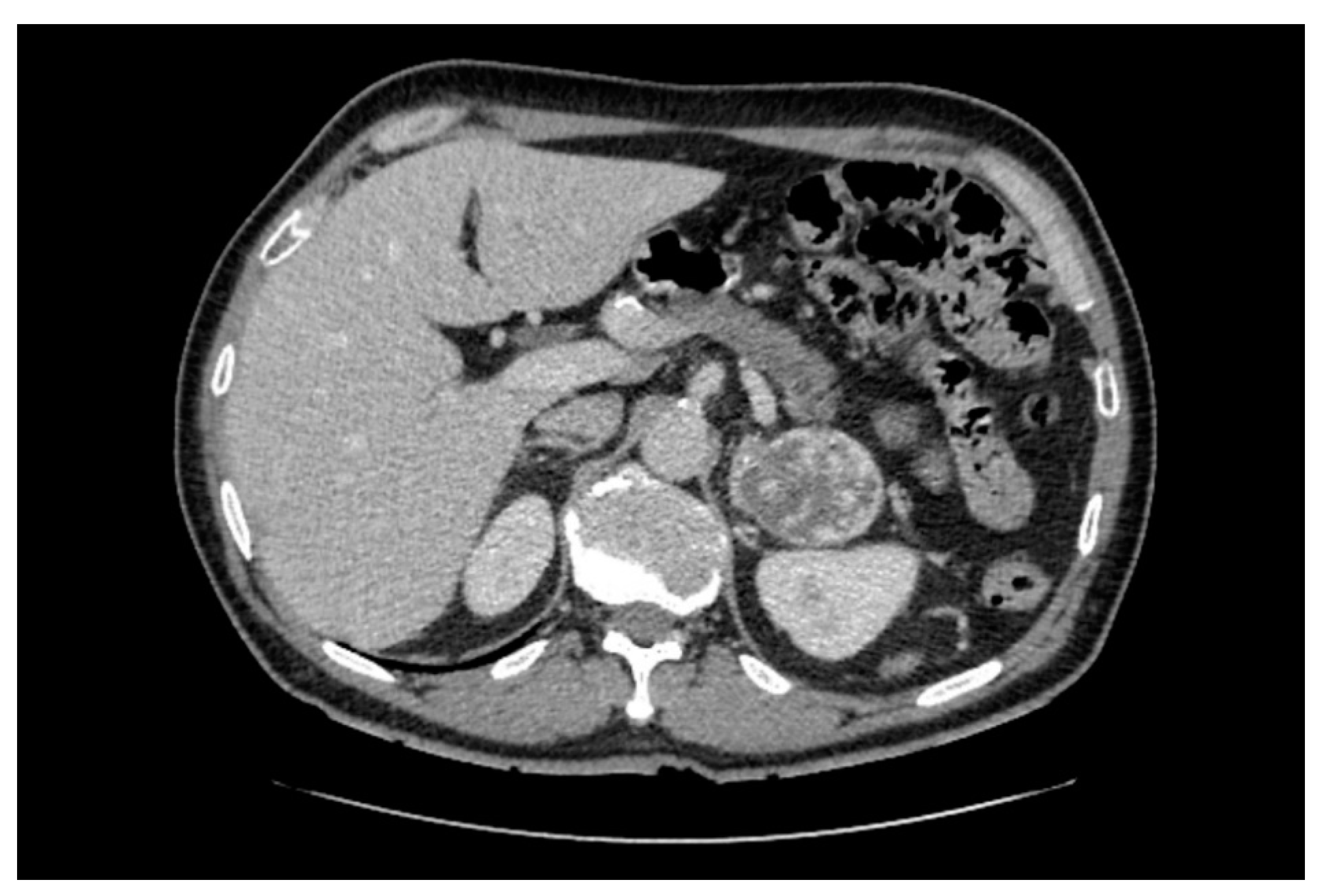 Cancers 14 00917 g002