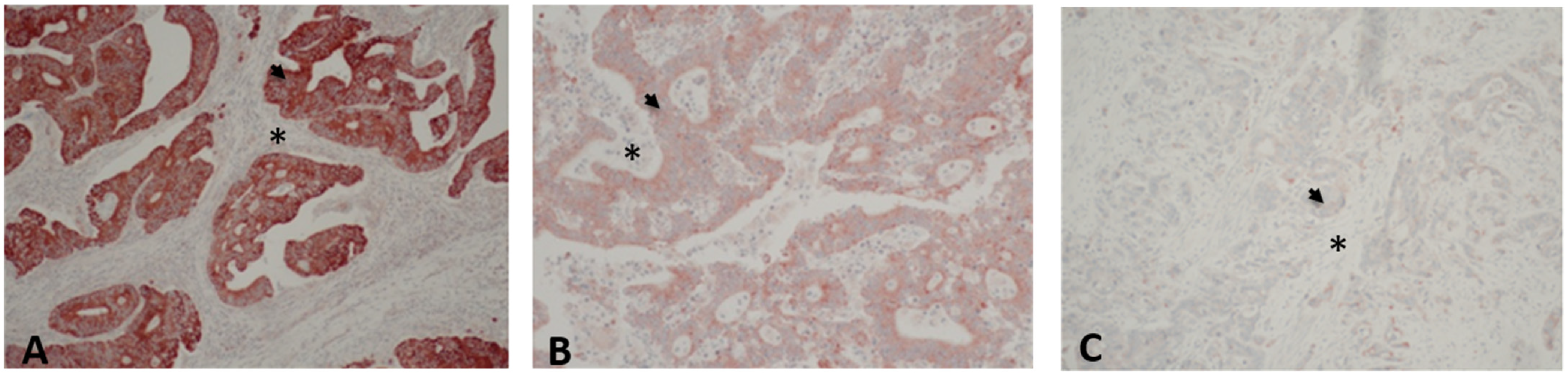 Cancers 14 00928 g001