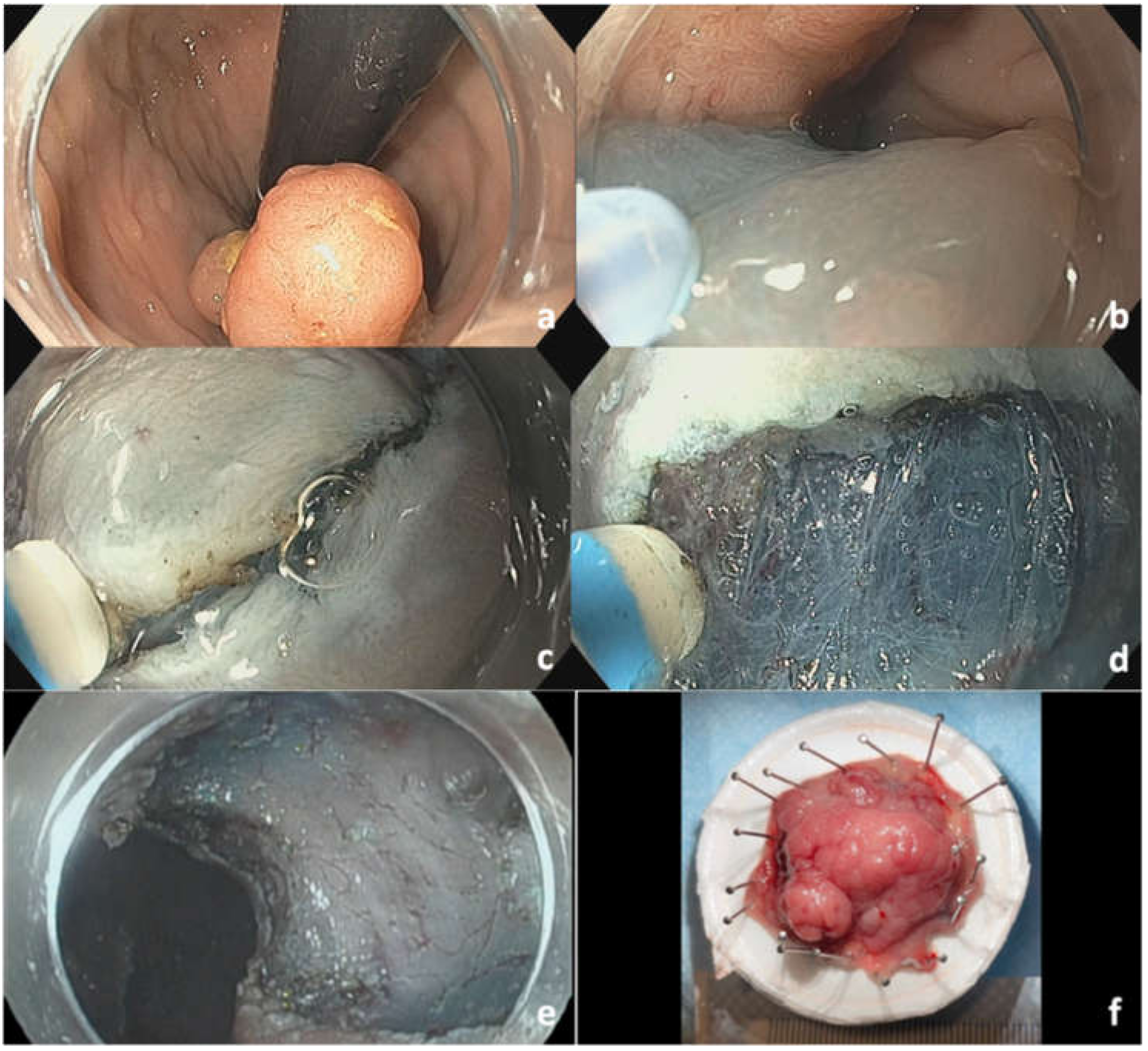 Cancers 14 00948 g005