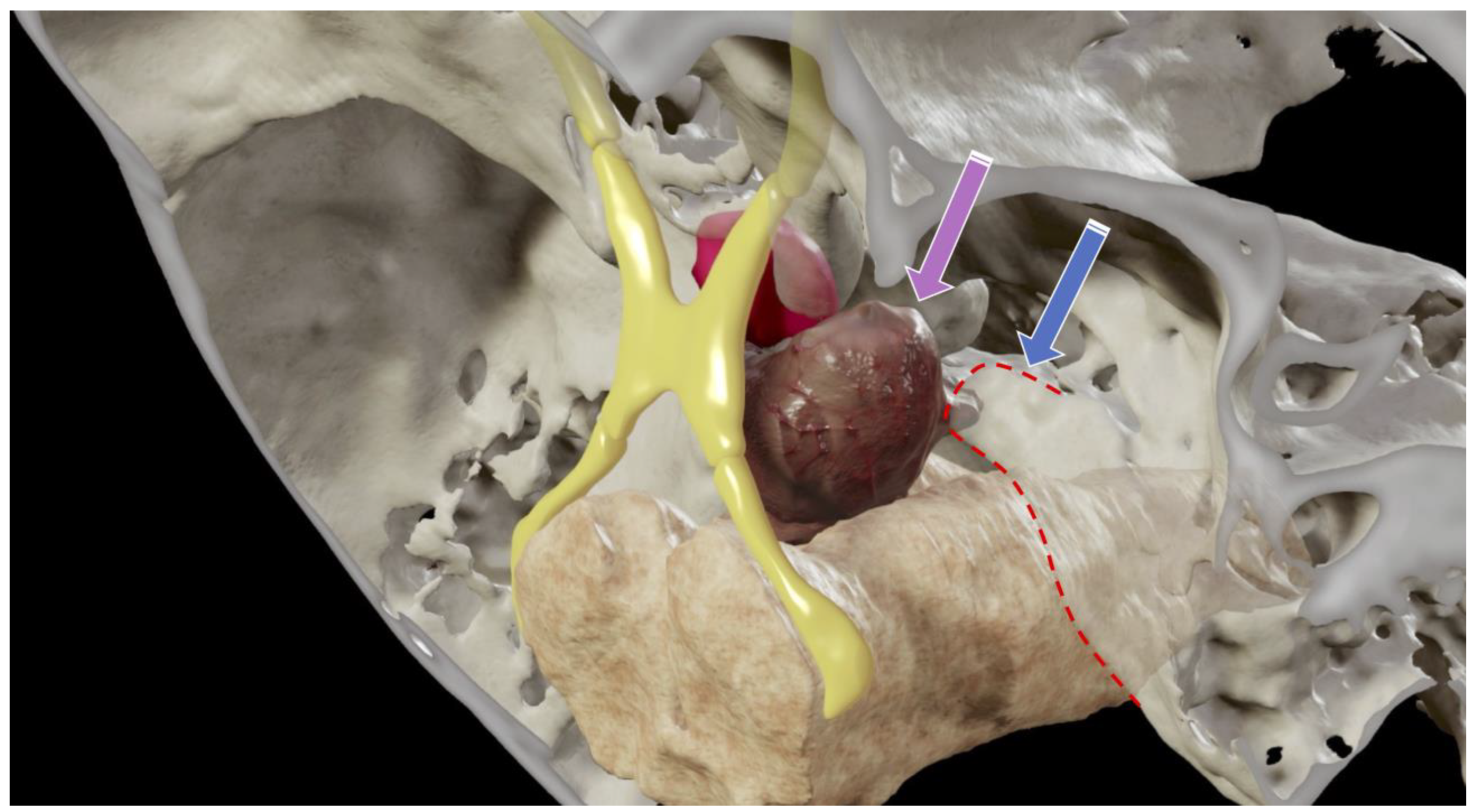 Cancers 14 00966 g003