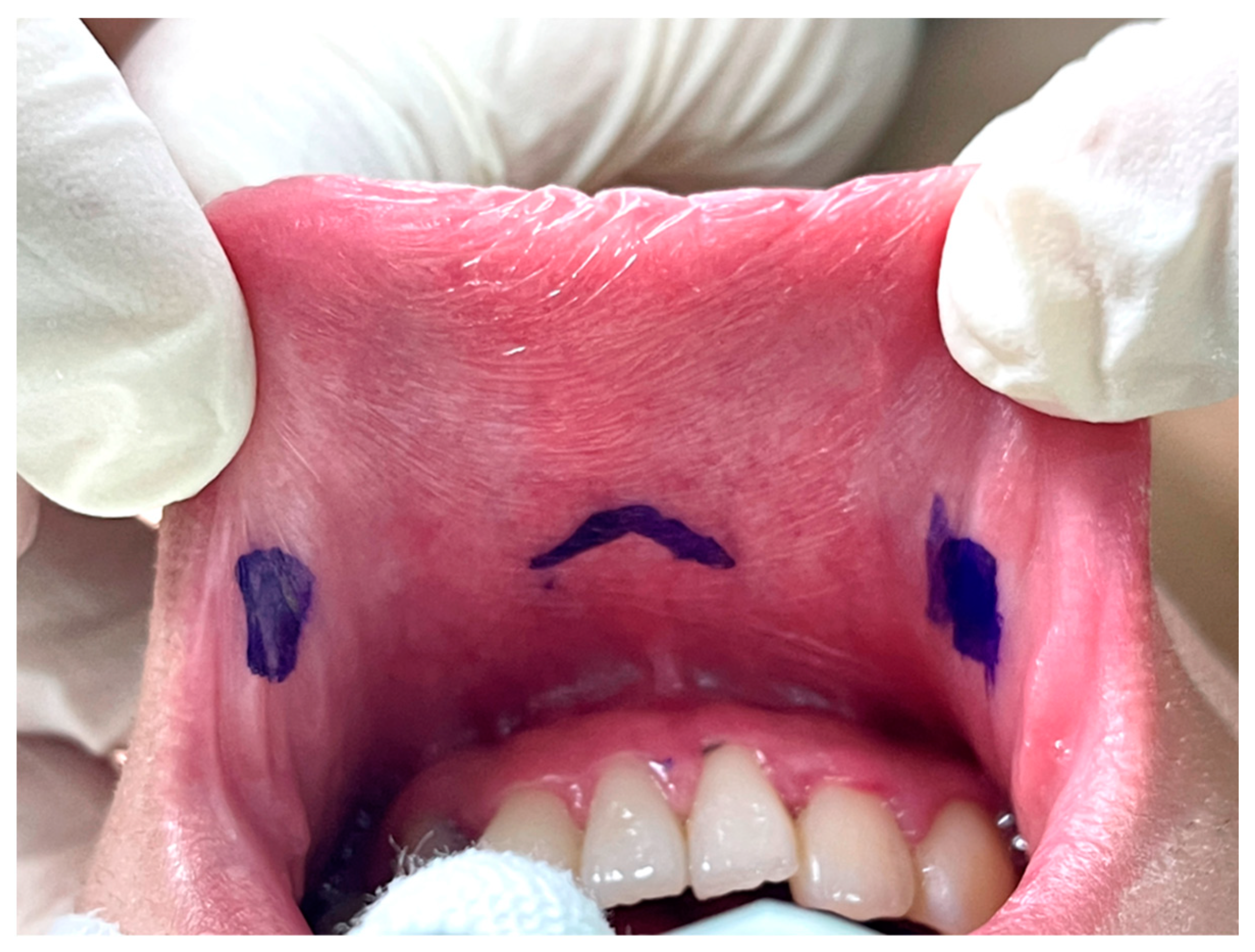 Cancers 14 01031 g002 550