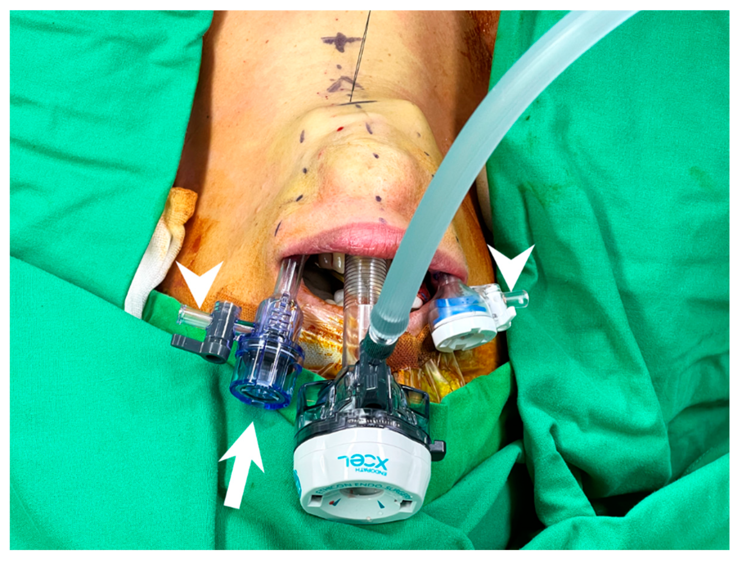 Cancers 14 01031 g005 550