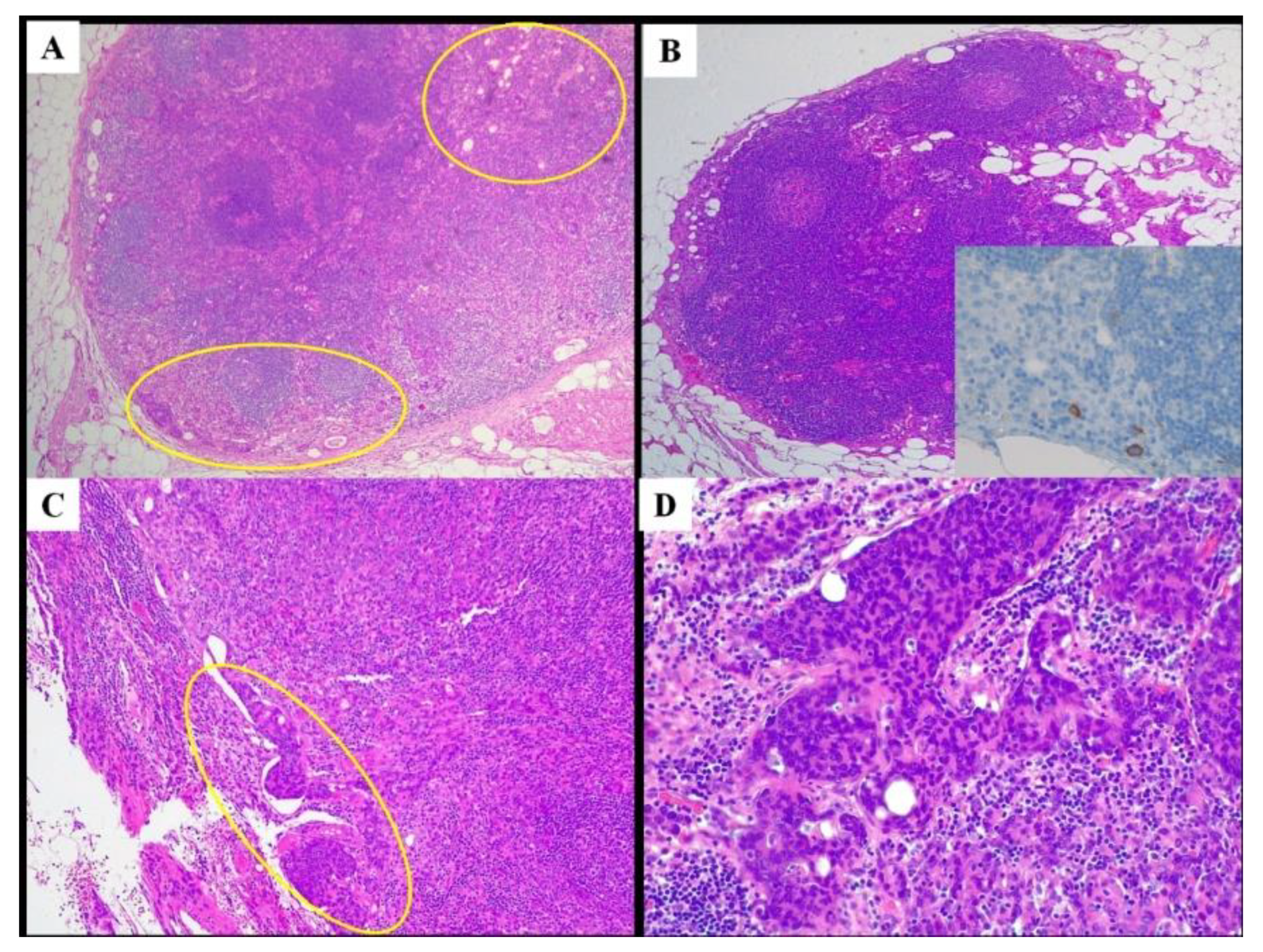 Cancers 14 01034 g002