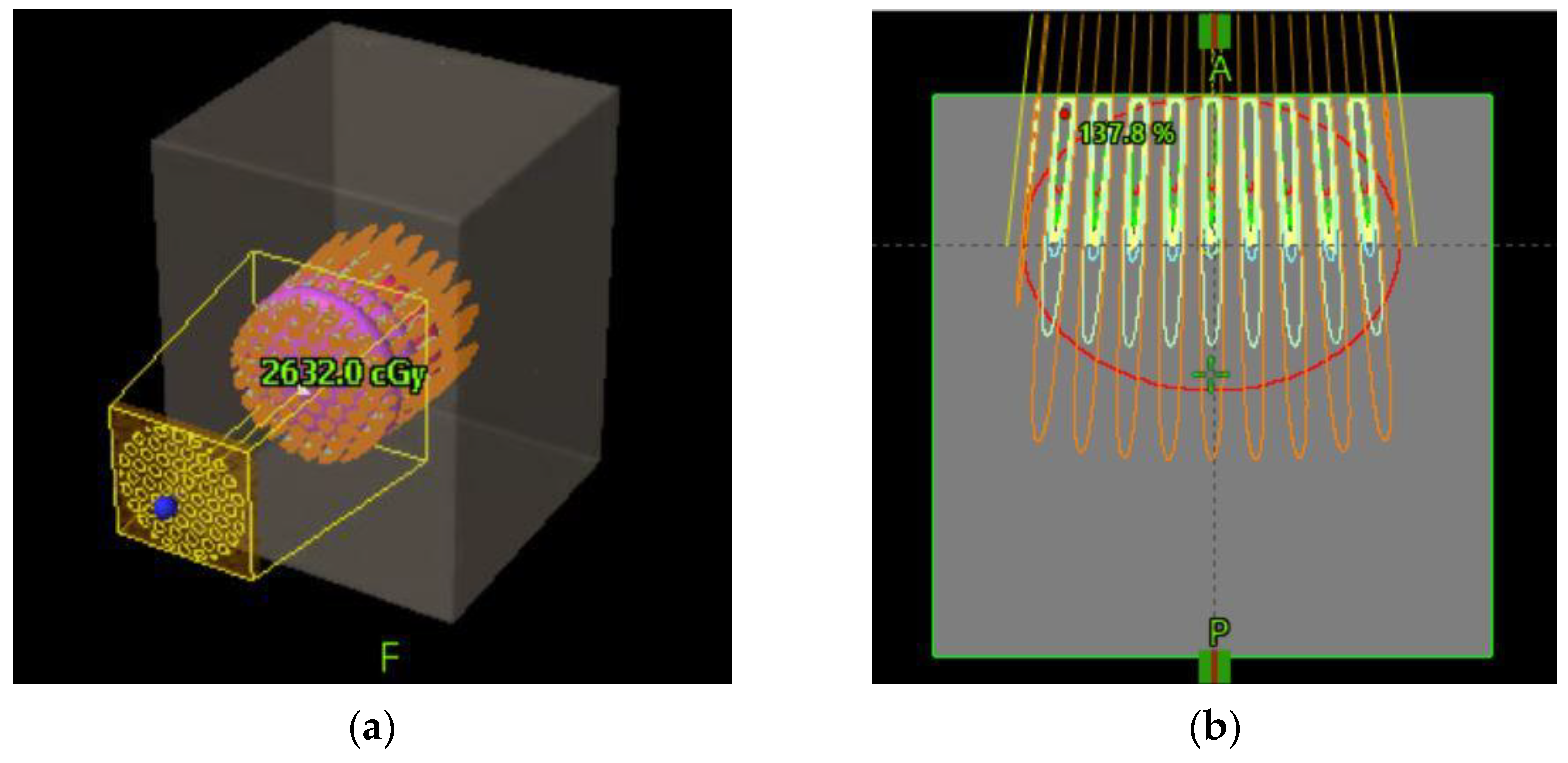 Cancers 14 01037 g006 550