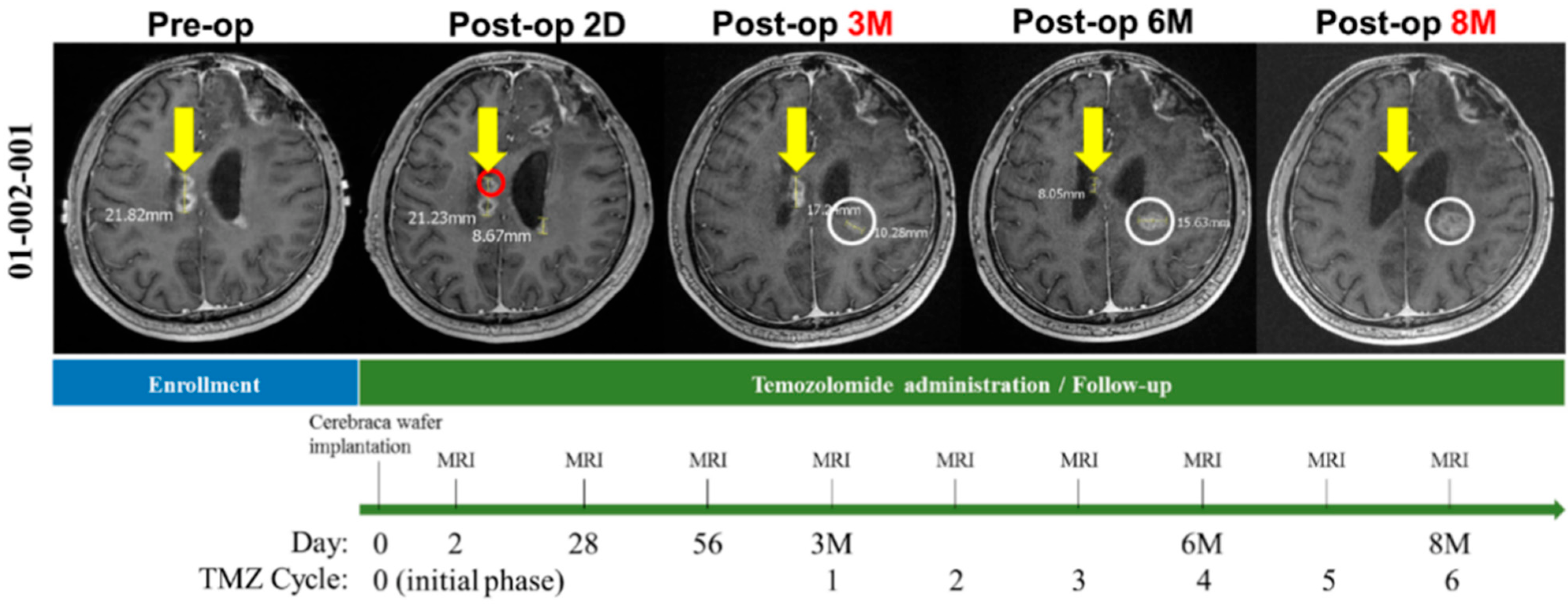 Cancers 14 01051 g002 550