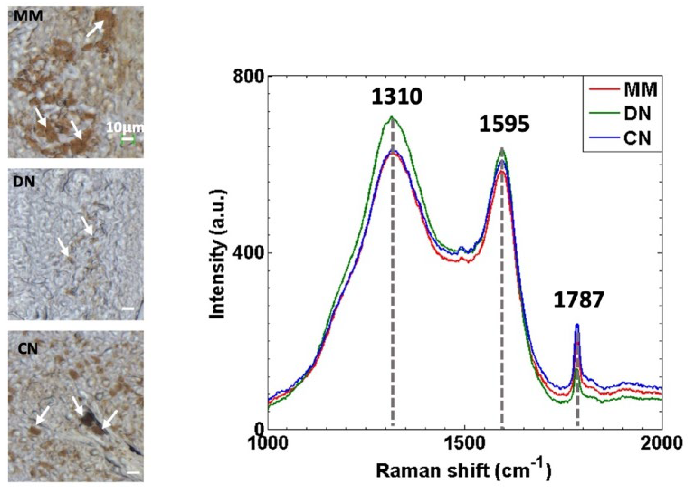 Cancers 14 01056 g001 550
