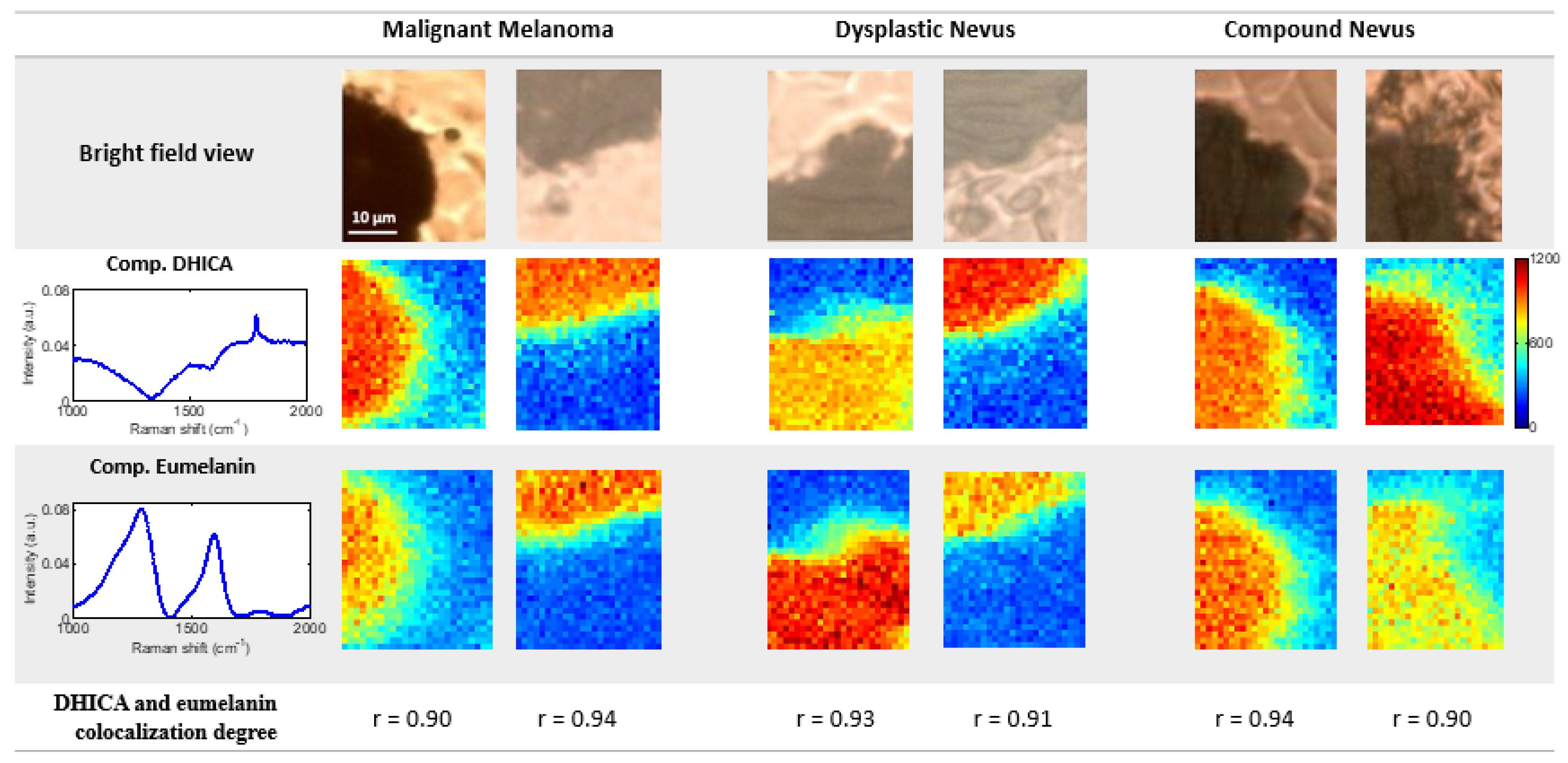 Cancers 14 01056 g003 550