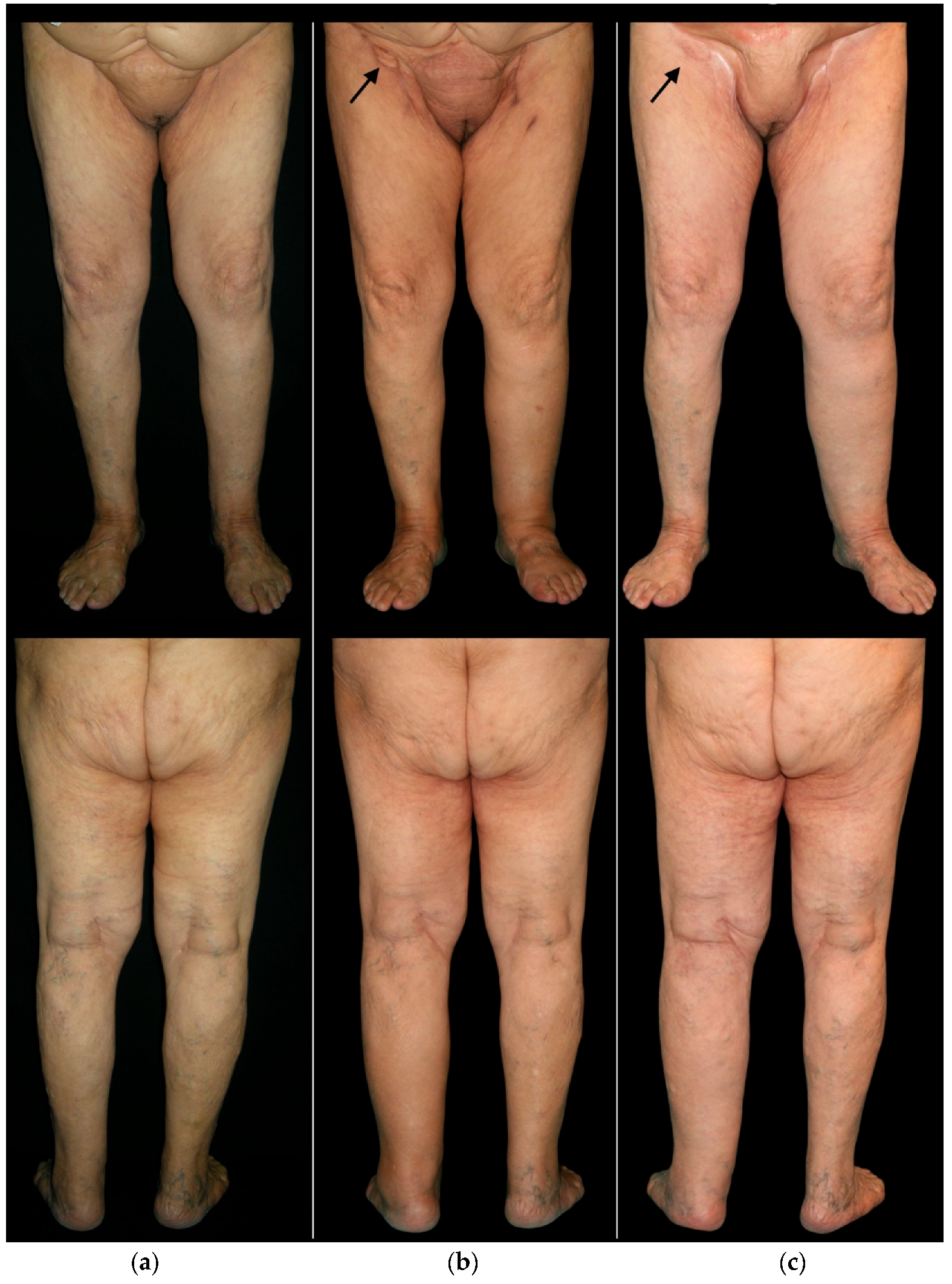 Cancers 14 01076 g001