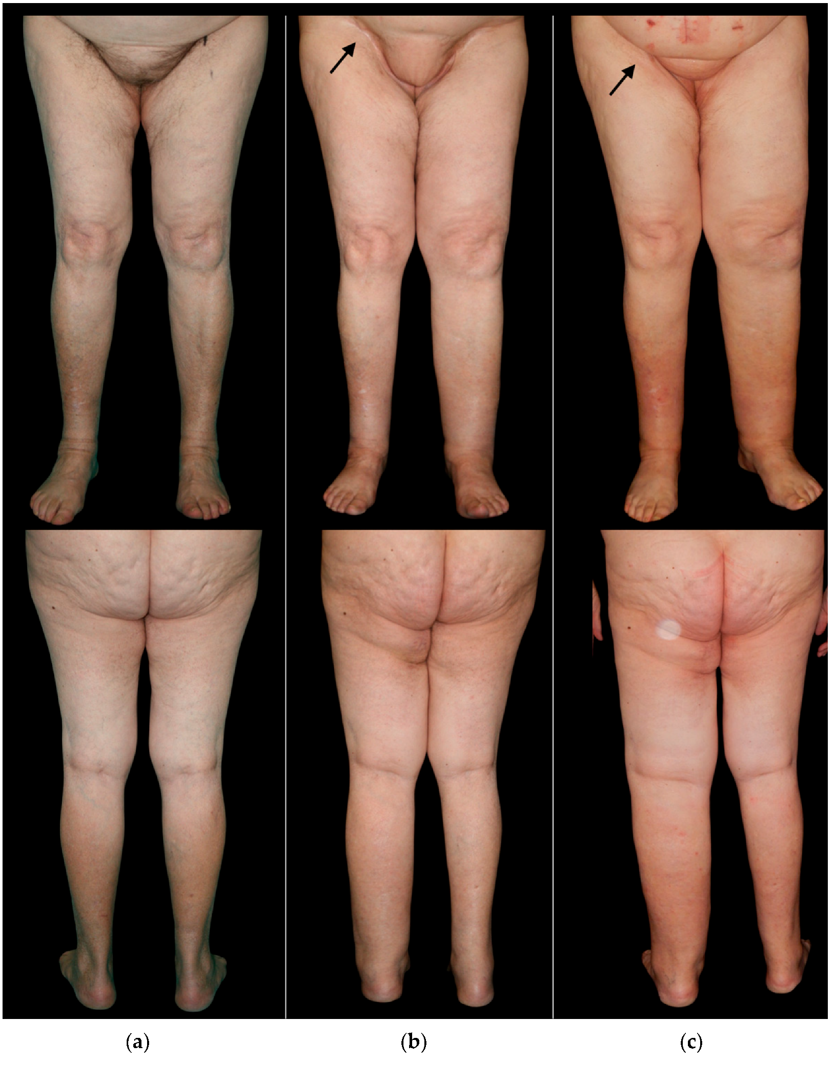 Cancers 14 01076 g002