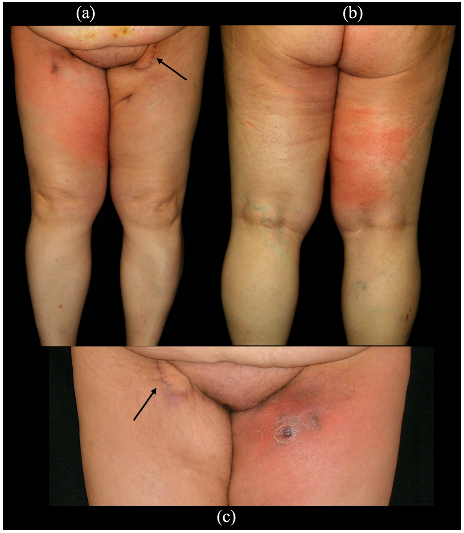 Cancers 14 01076 g004