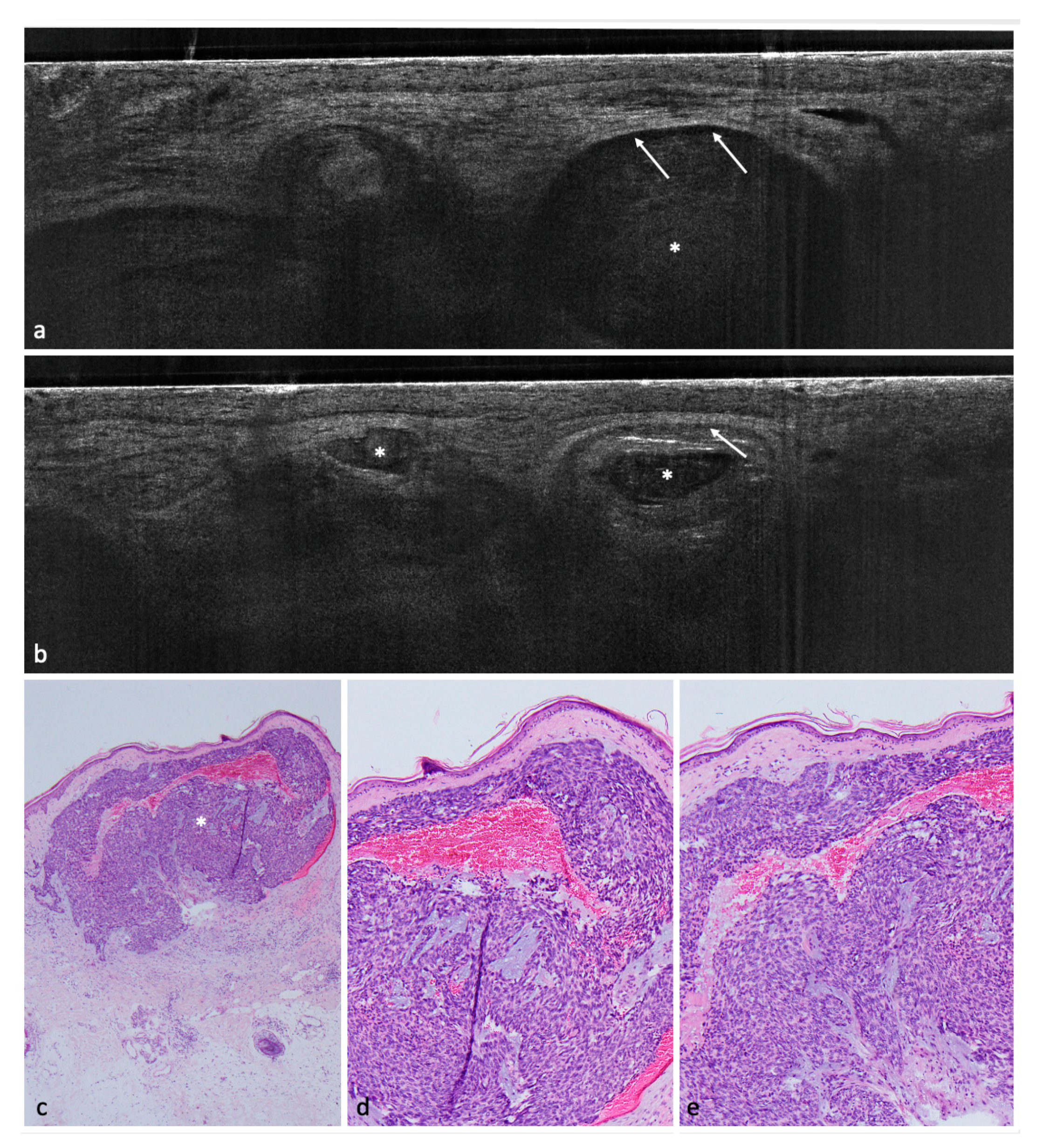Cancers 14 01082 g001 550