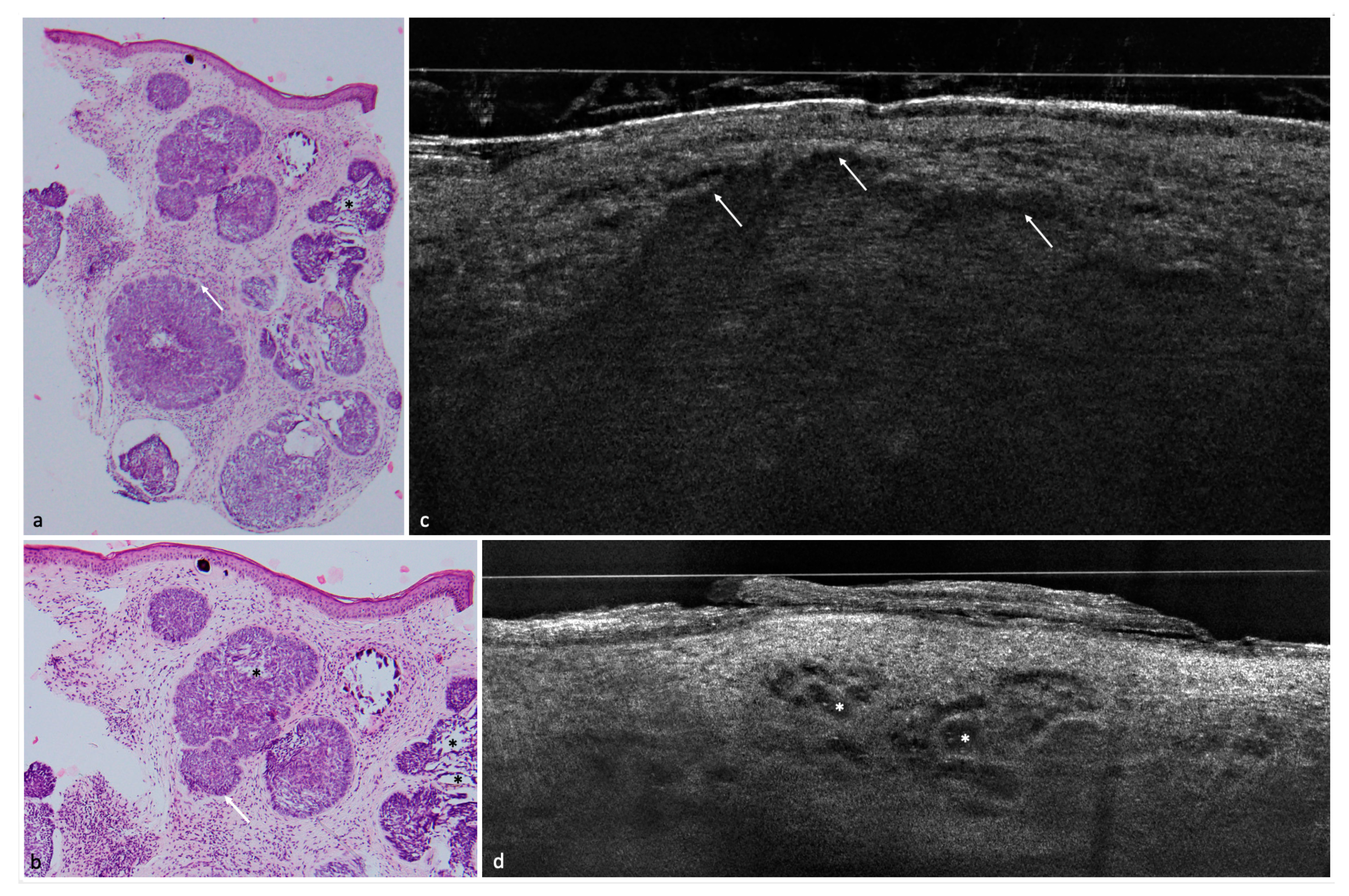 Cancers 14 01082 g002 550