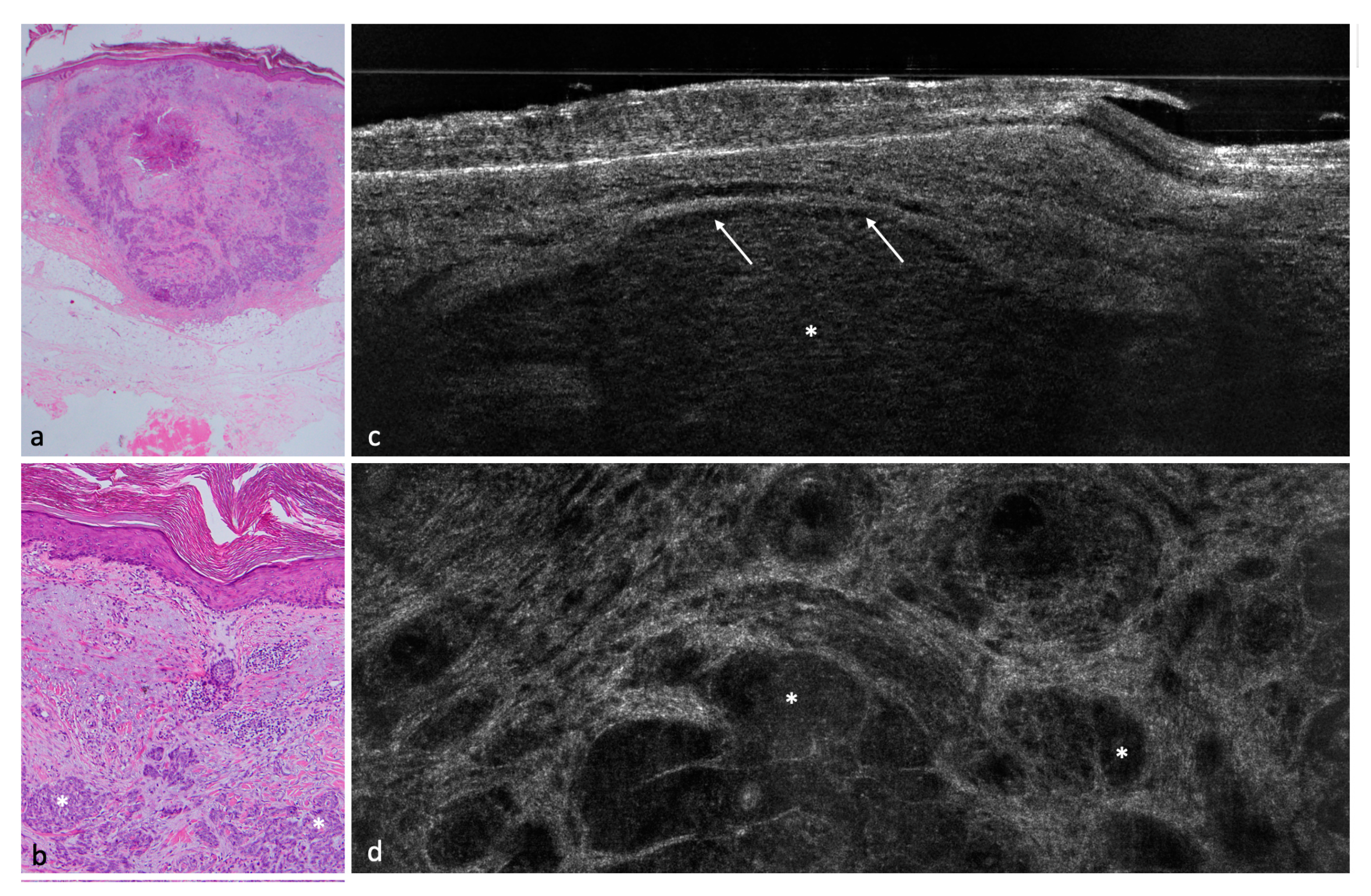Cancers 14 01082 g003 550