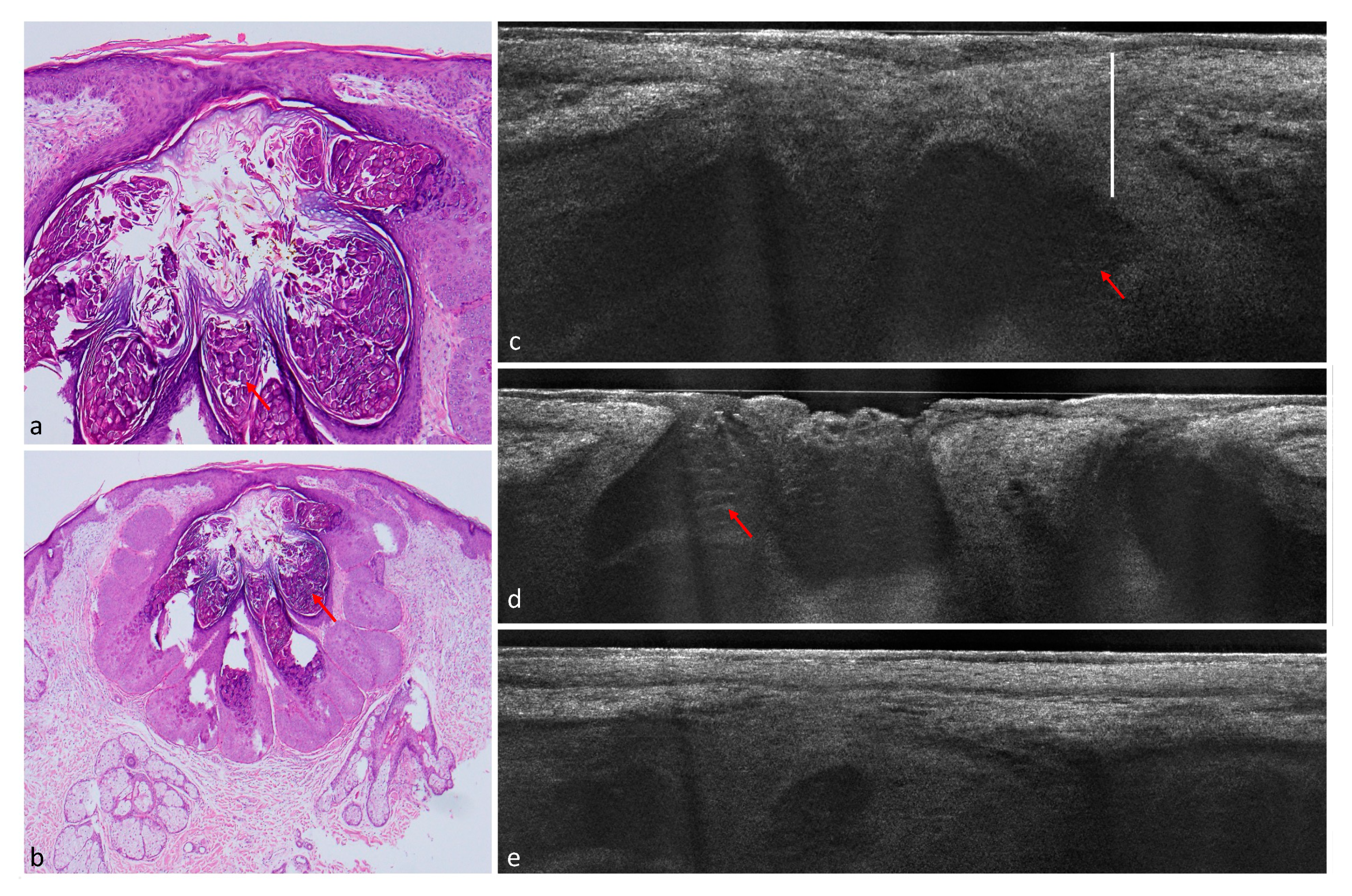 Cancers 14 01082 g004 550