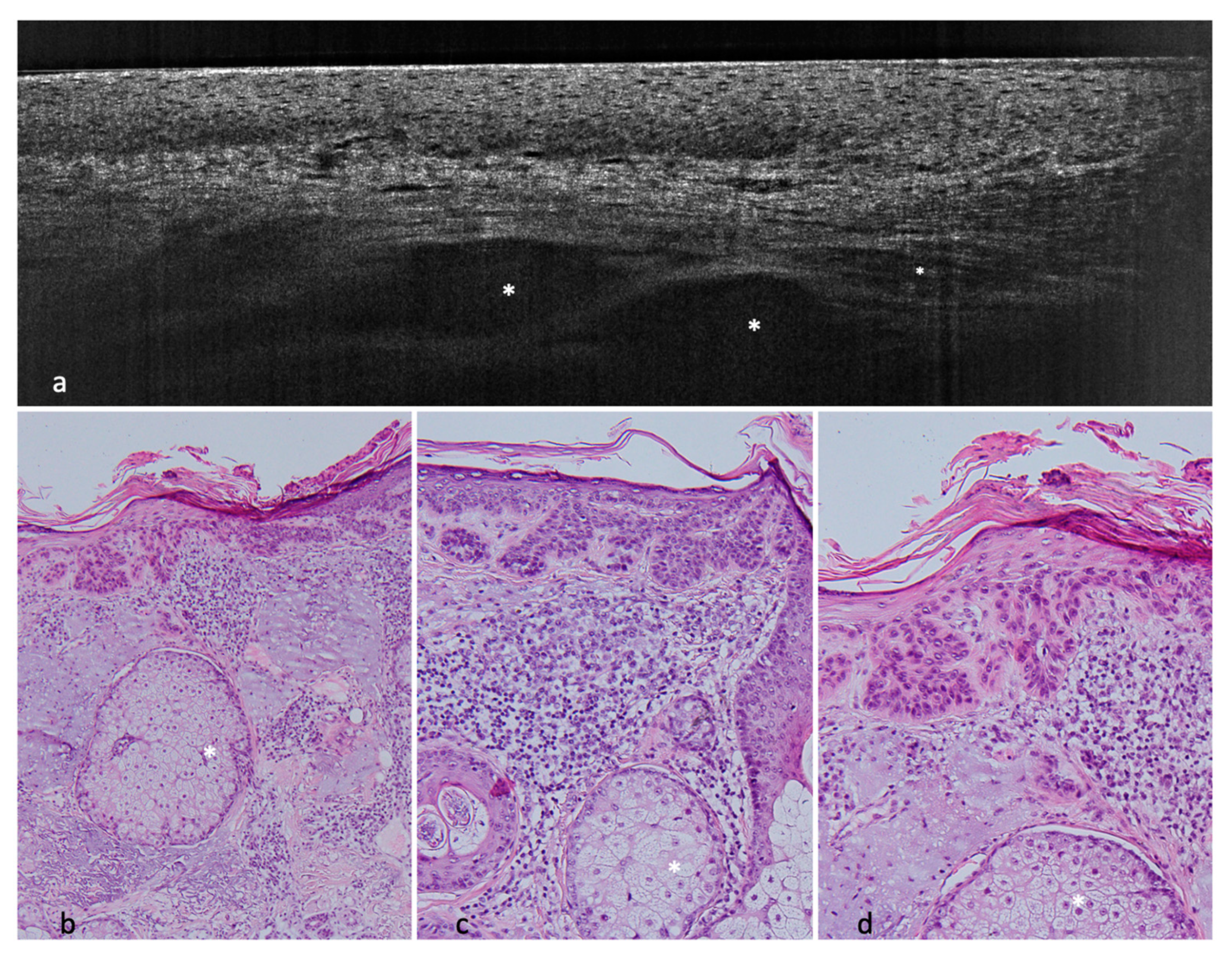 Cancers 14 01082 g005 550