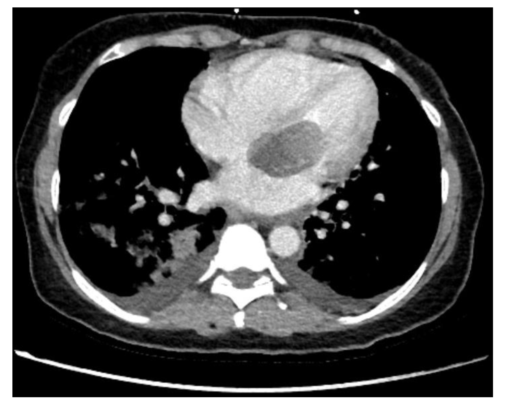 Cancers 14 01111 g002 550