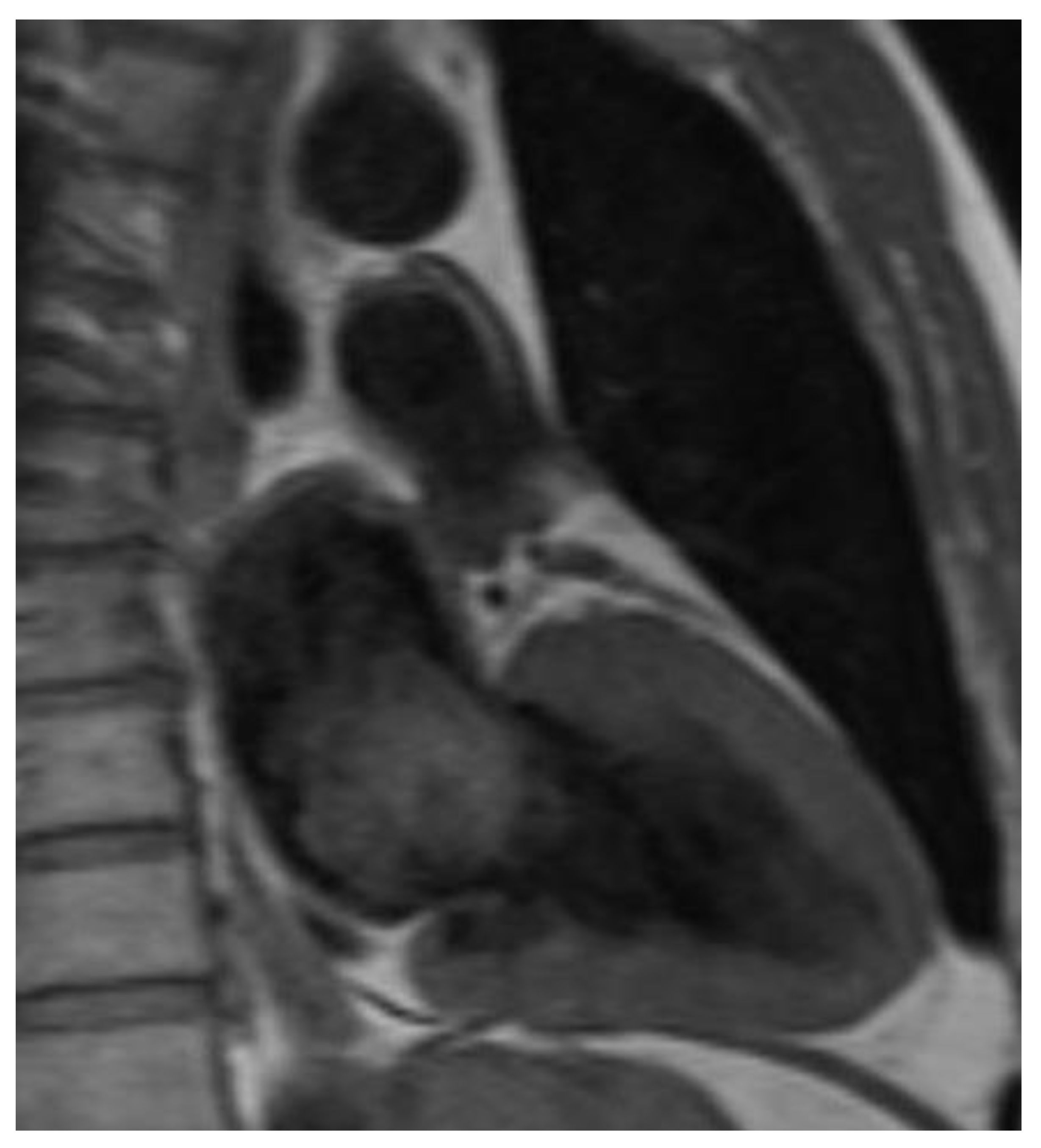 Cancers 14 01111 g003 550