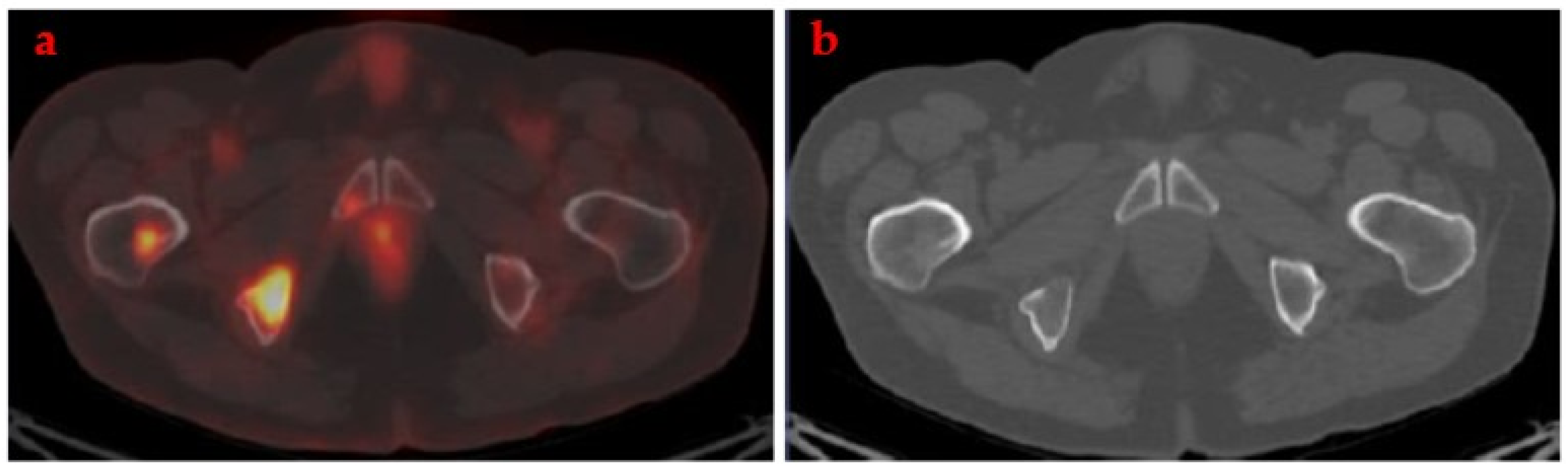 Cancers 14 01130 g001 Cancers 14 01130 g001