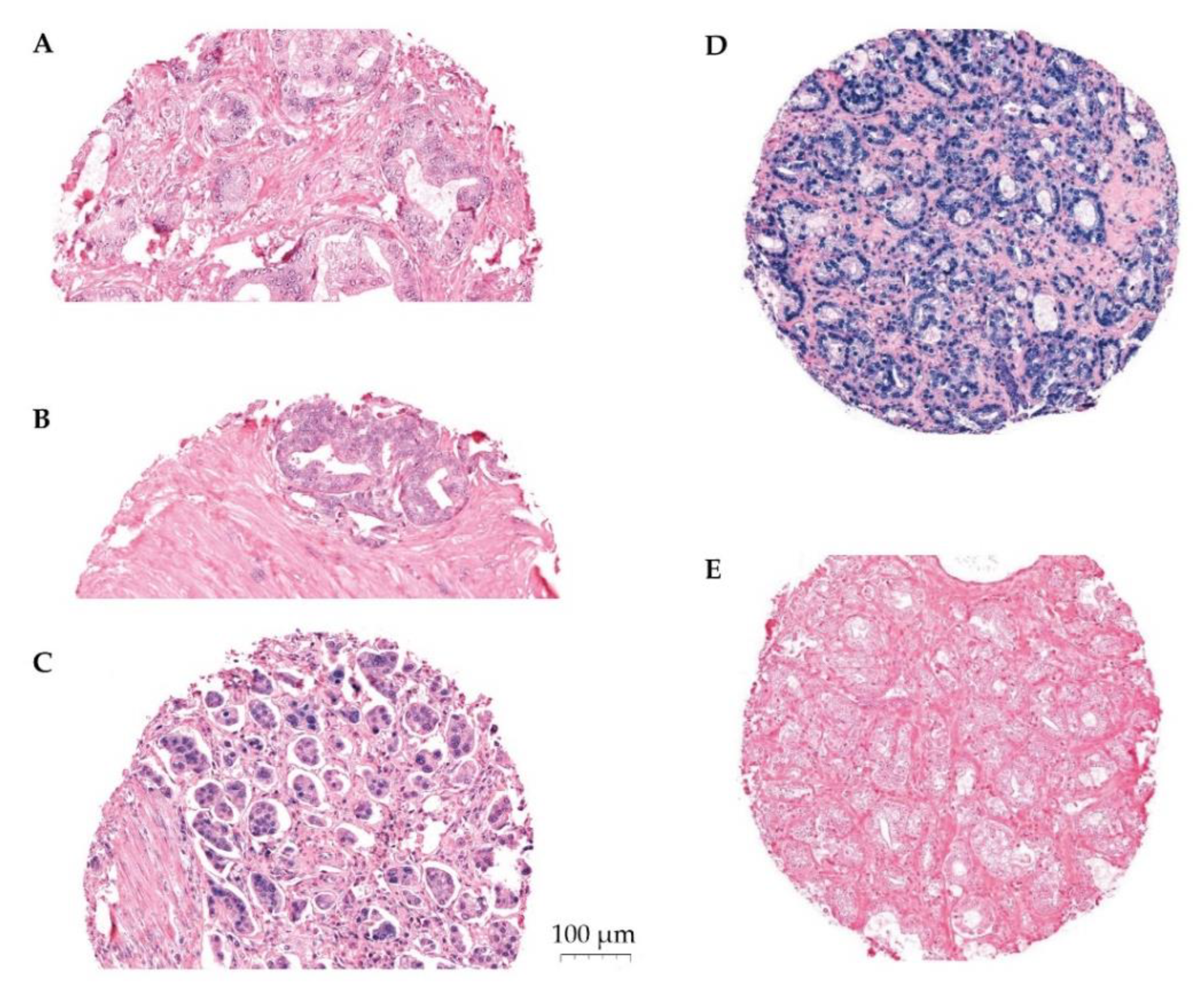 Cancers 14 01142 g001 550