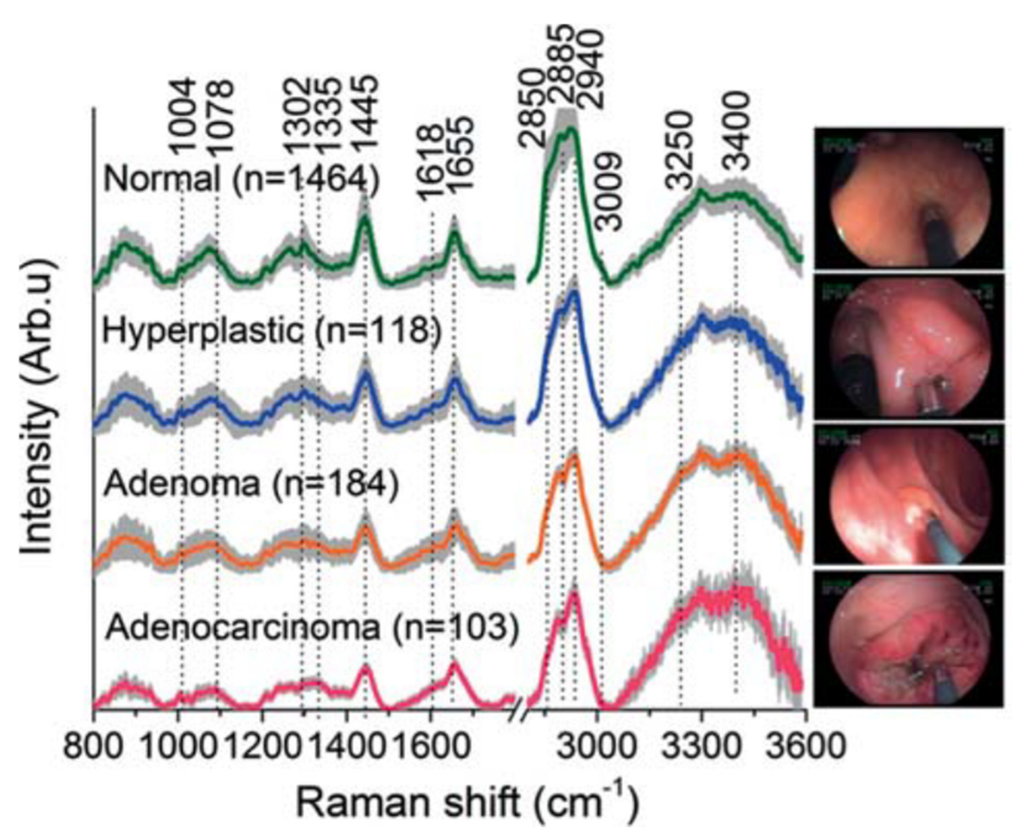 Cancers 14 01144 g001