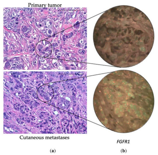 Cancers | Free Full-Text | Differences in the Molecular Profile between ...