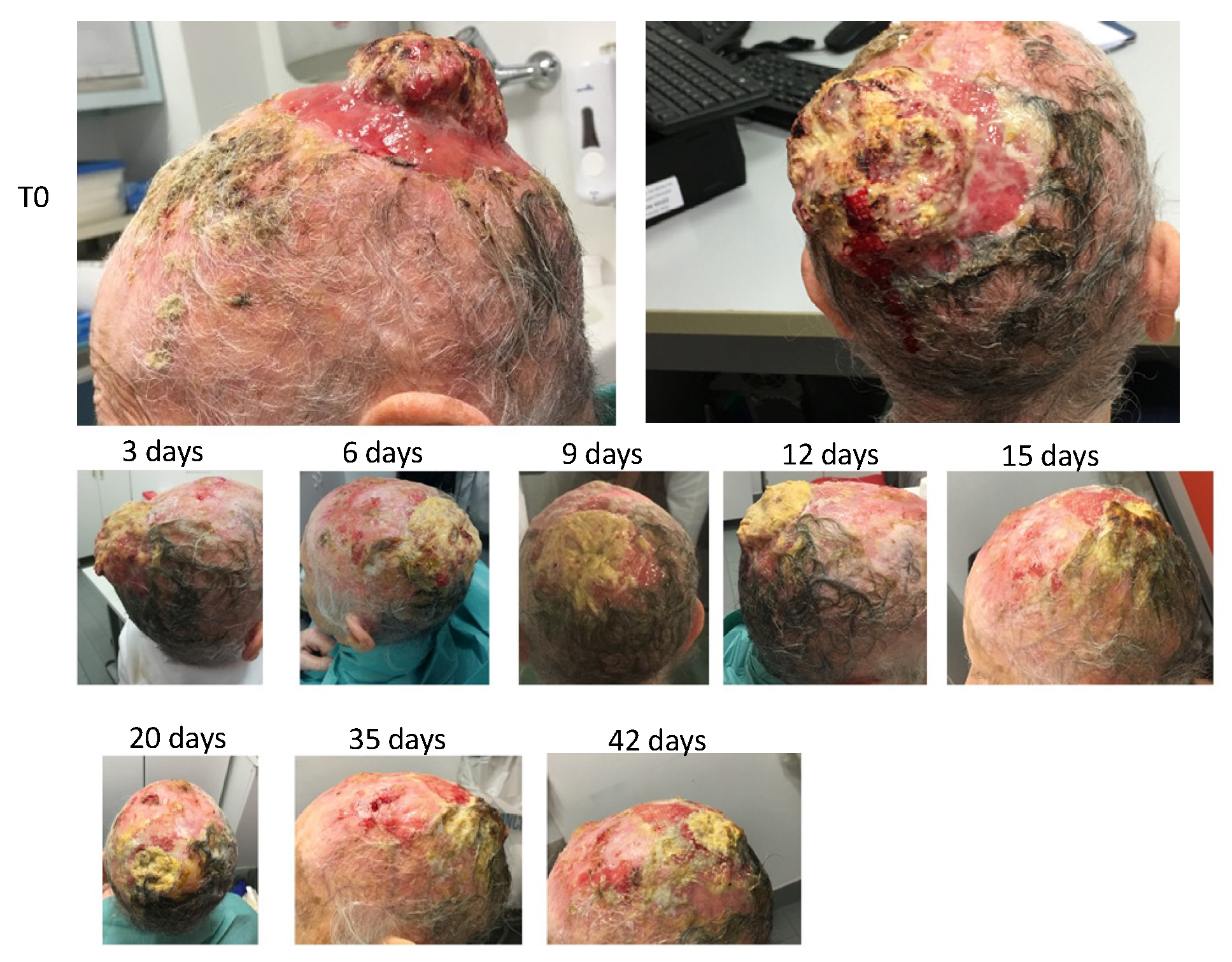 Cancers 14 01174 g013