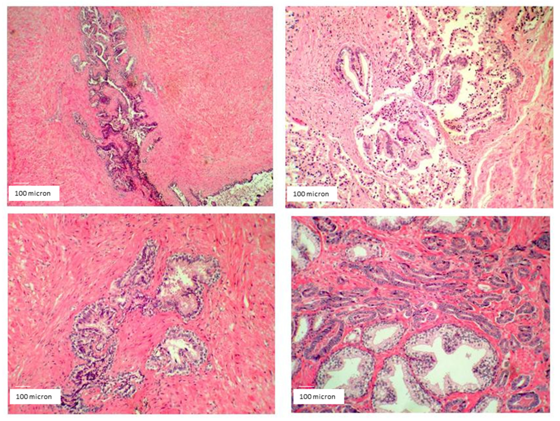 Cancers 14 01174 g015