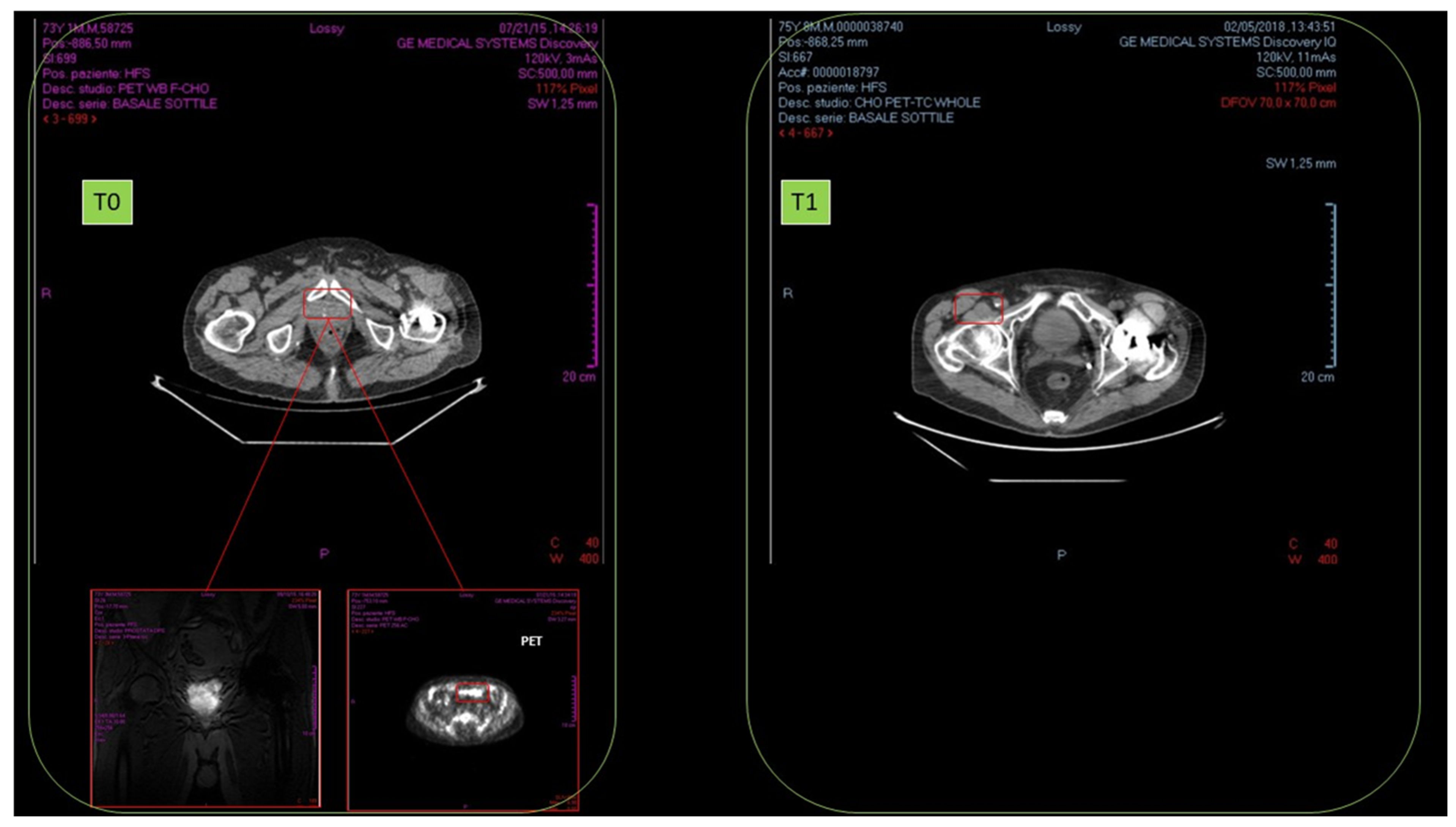 Cancers 14 01174 g016