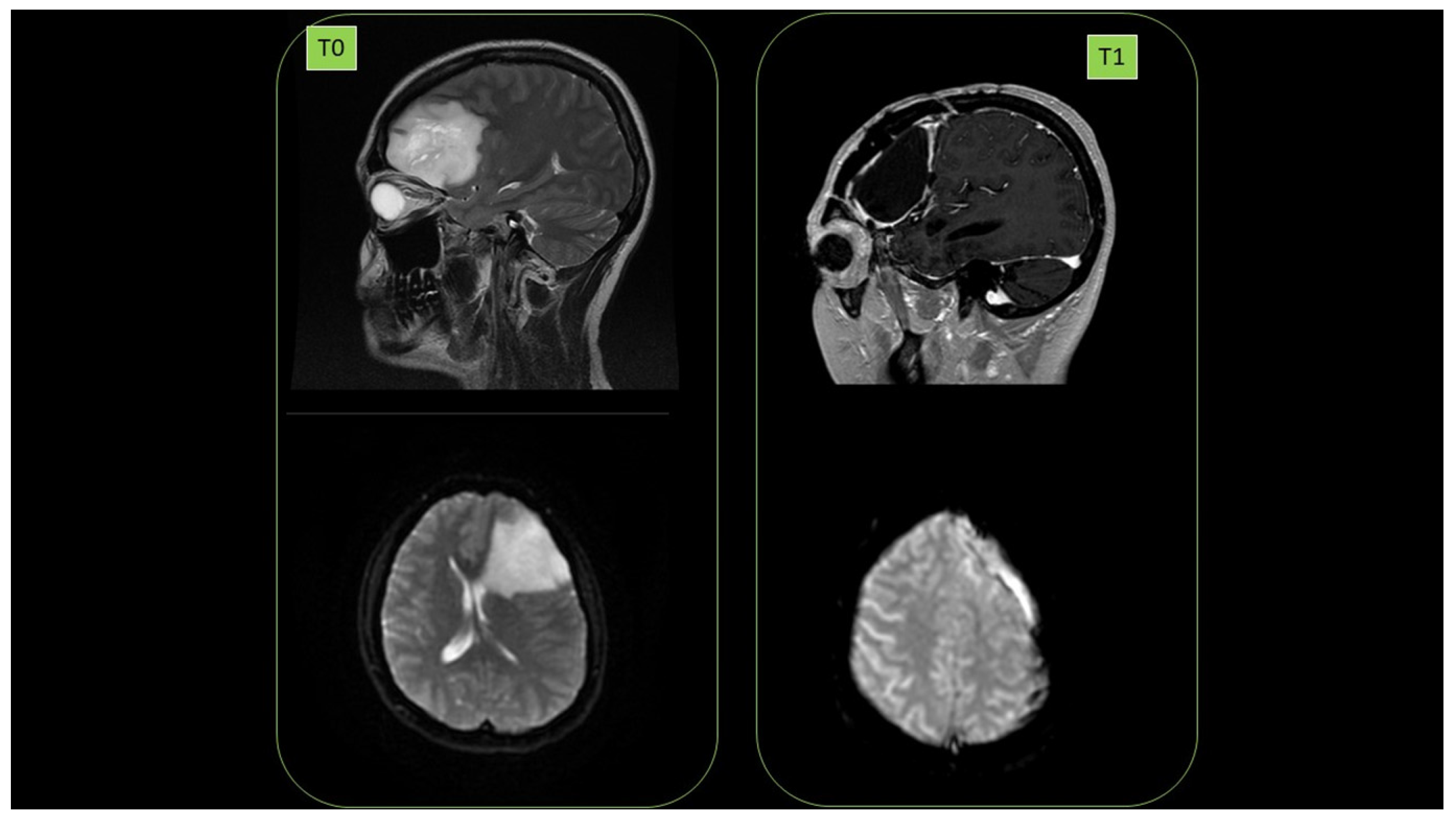 Cancers 14 01174 g017