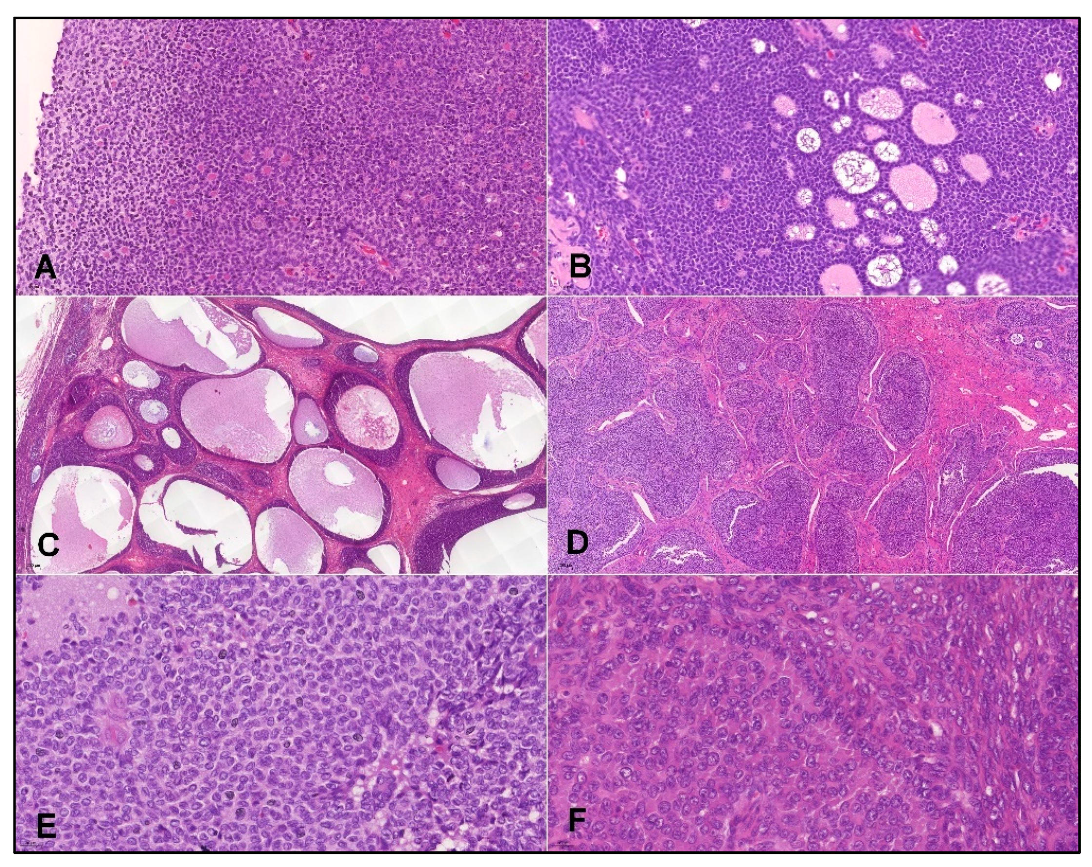 Cancers 14 01208 g001 Cancers 14 01208 g001