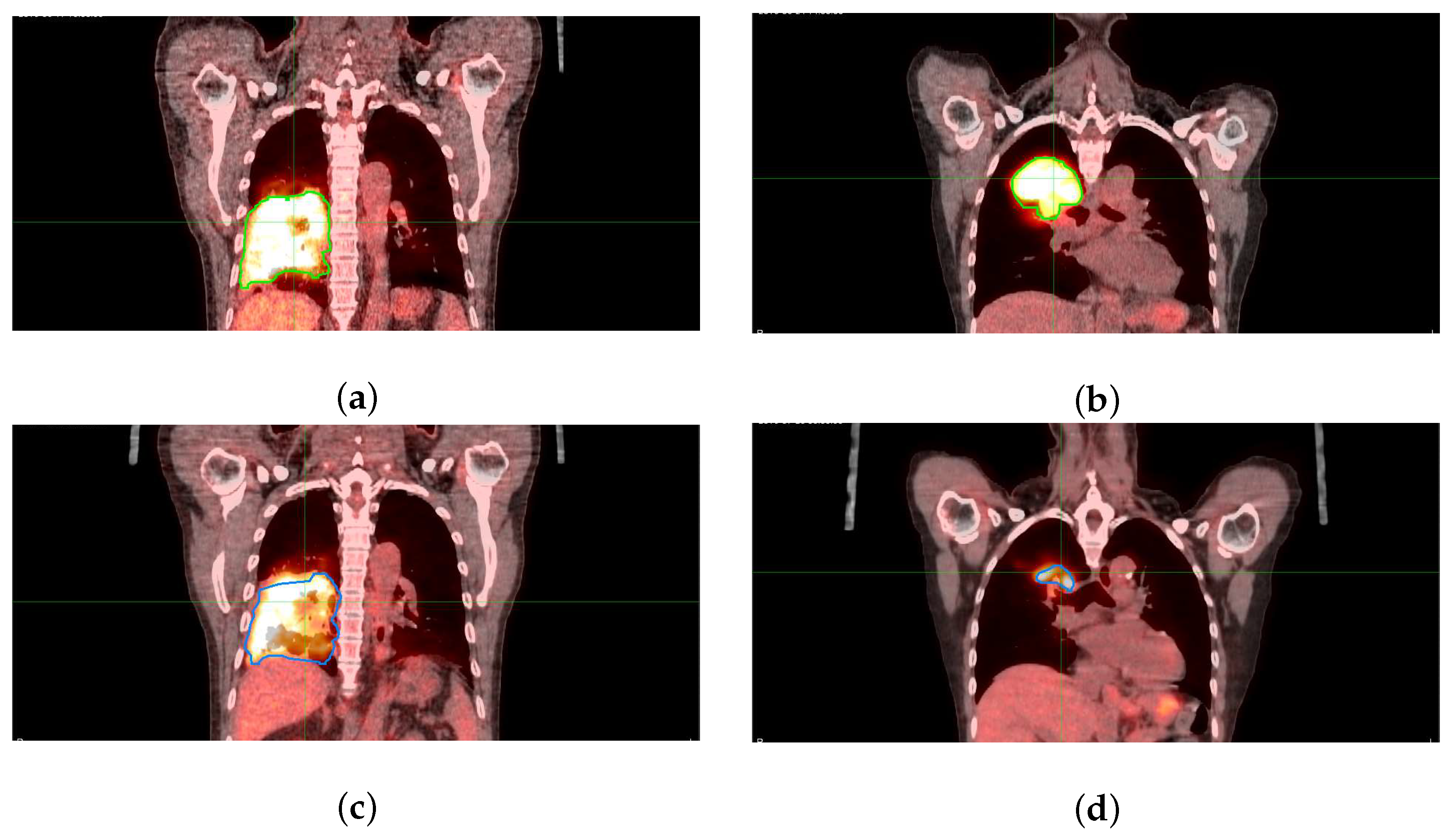 Cancers 14 01228 g001