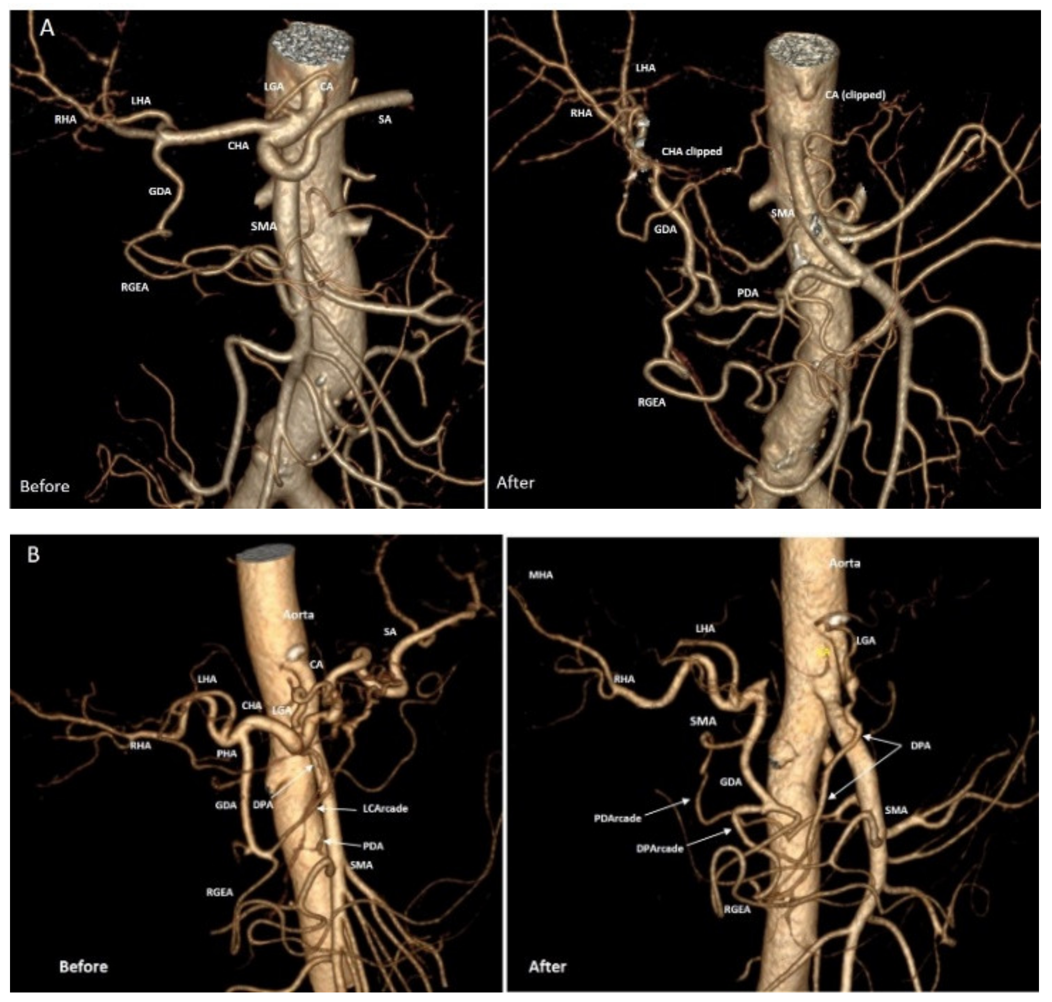 Cancers 14 01254 g005 550