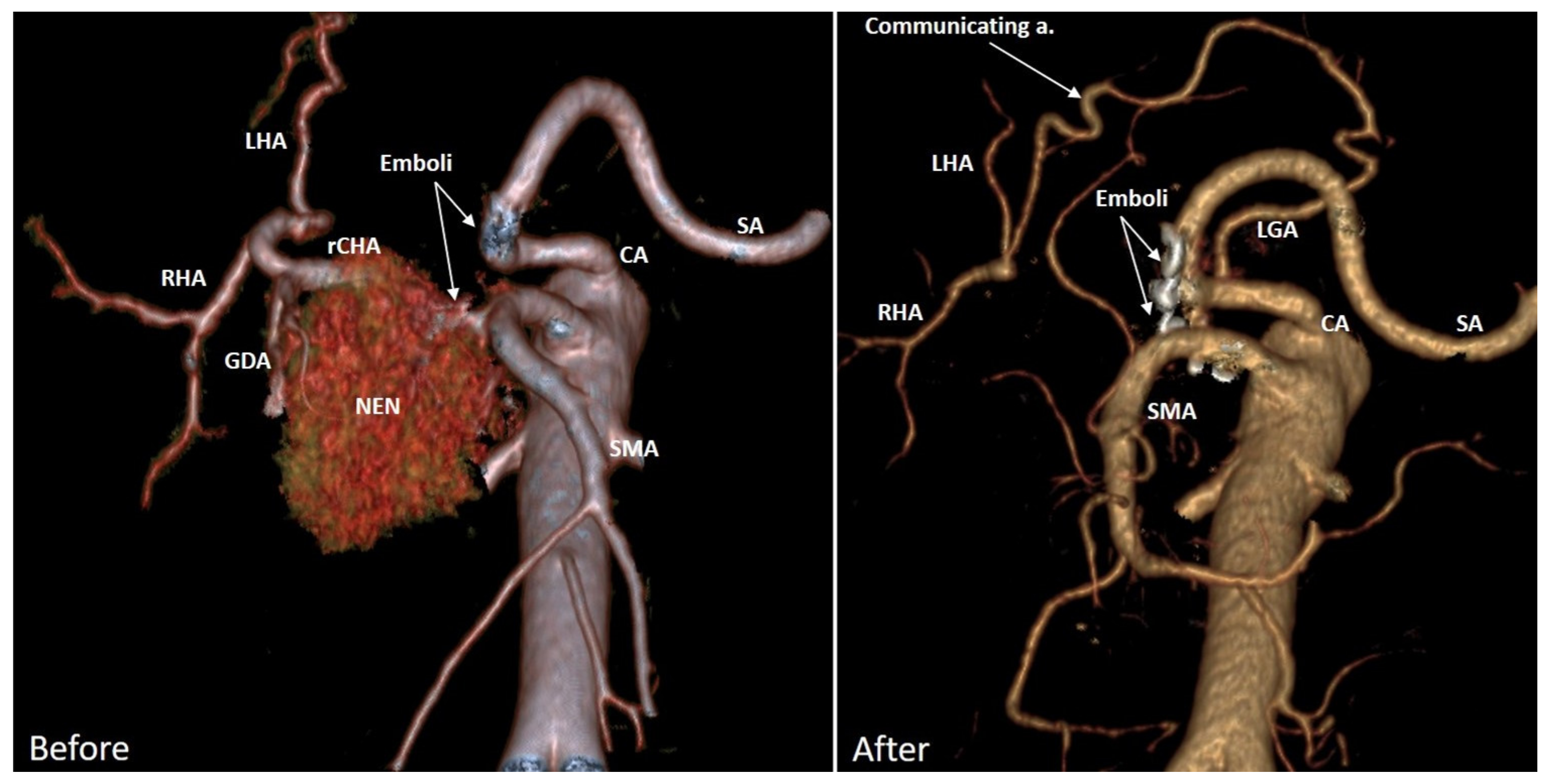 Cancers 14 01254 g006 550