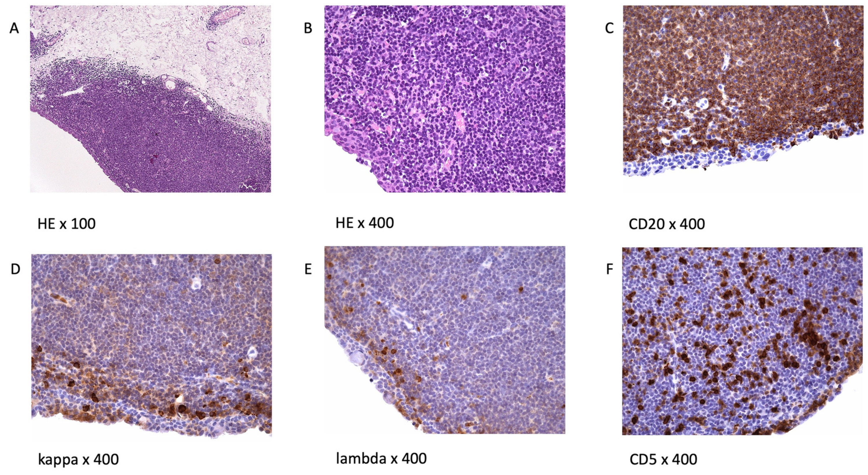 Cancers 14 01264 g001 Cancers 14 01264 g001