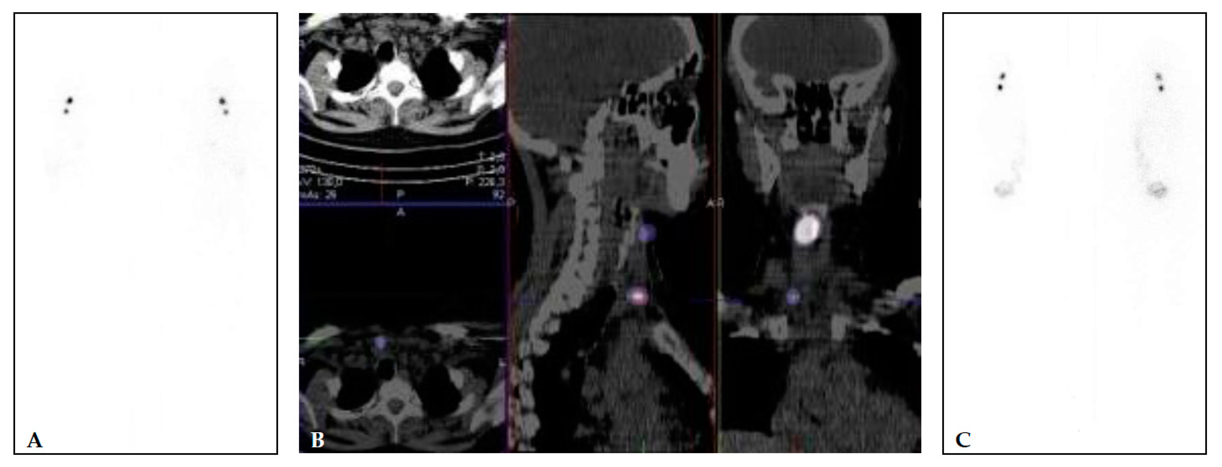 アウトレット福袋 and Imaging Molecular Theragnostics Cancers Thyroid of 語学+参考書