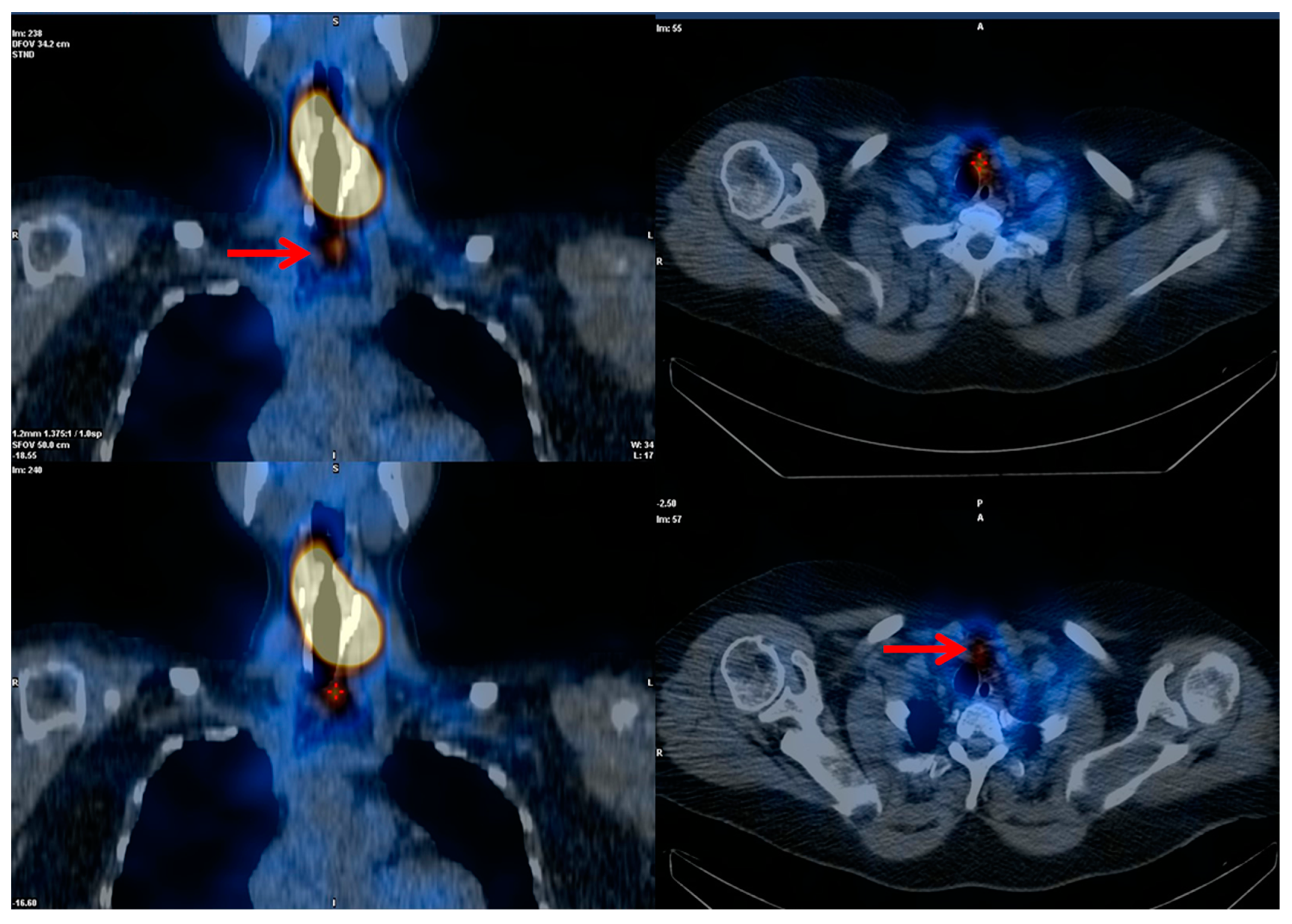 Cancers 14 01272 g002