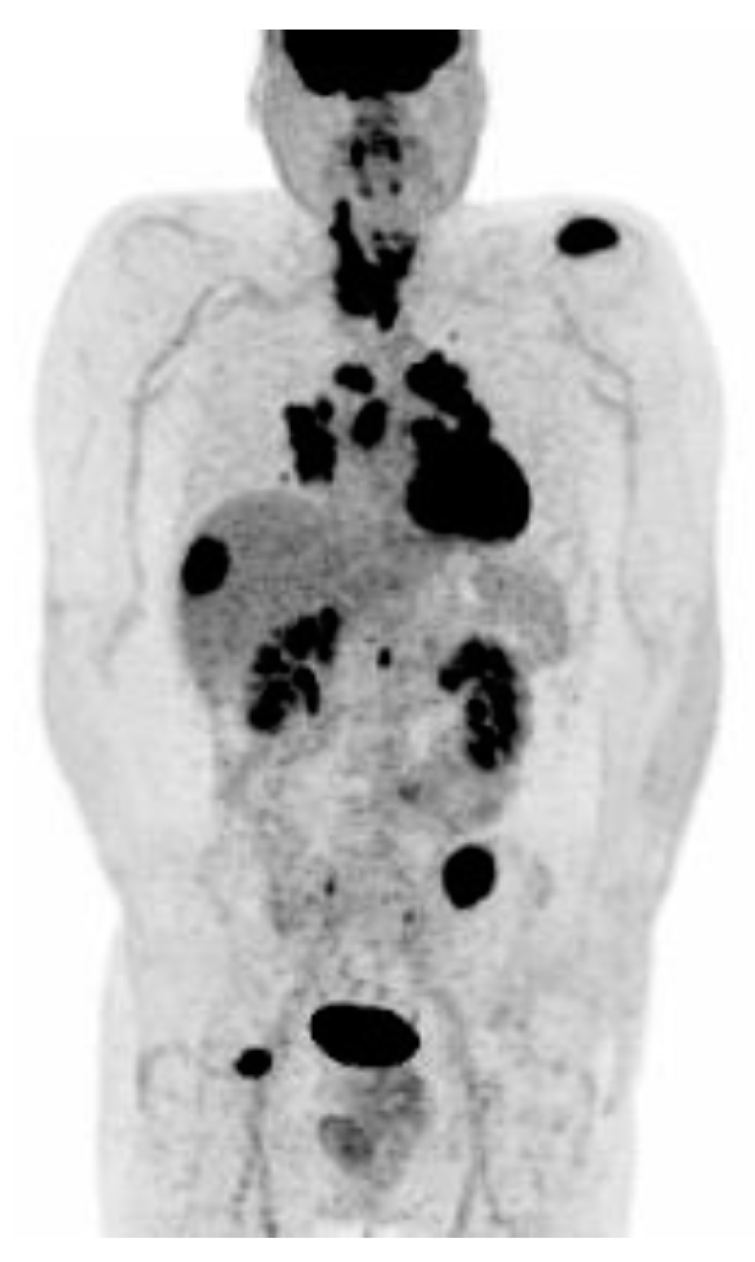 Cancers 14 01272 g005