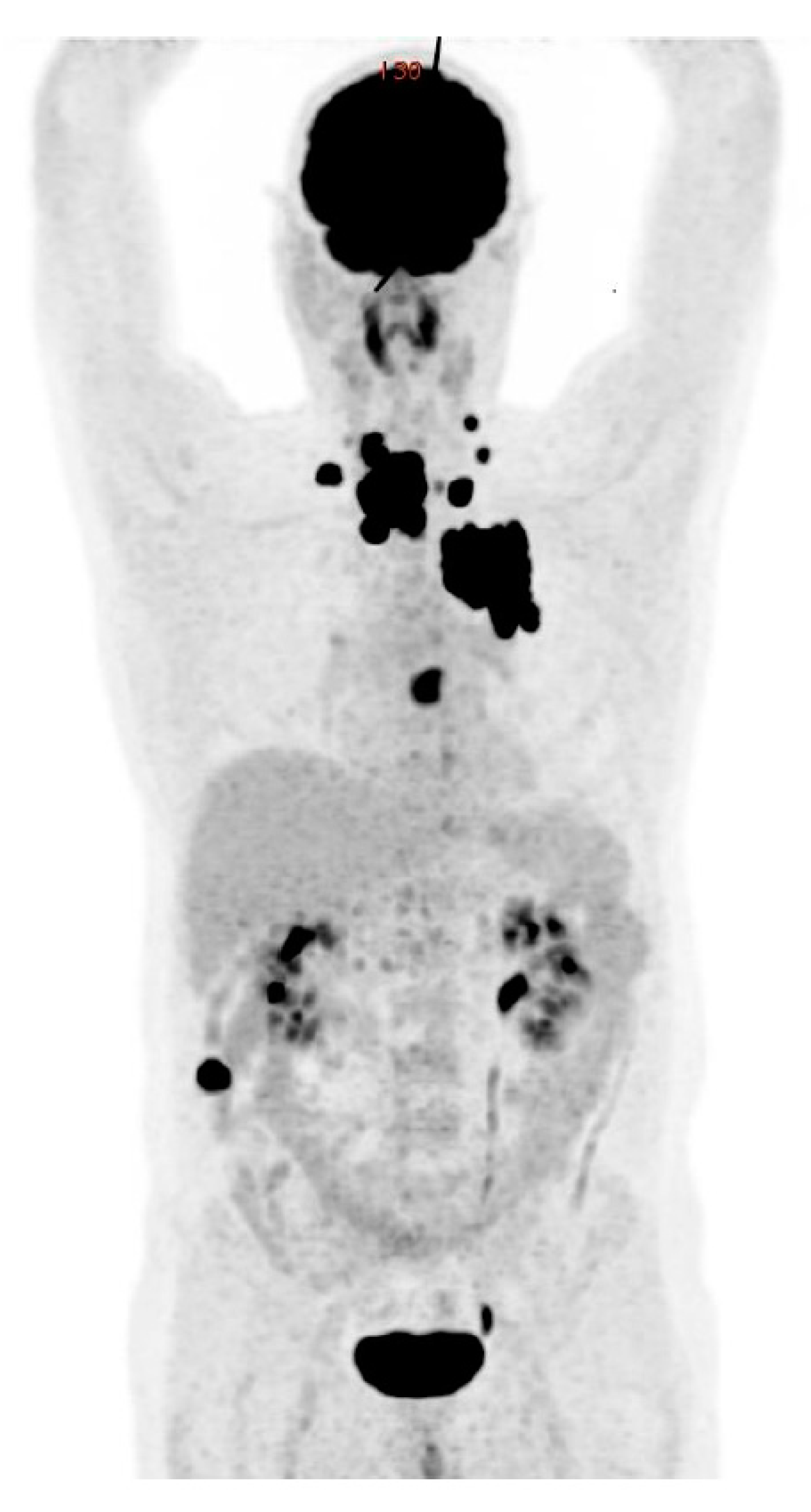 Cancers 14 01272 g006