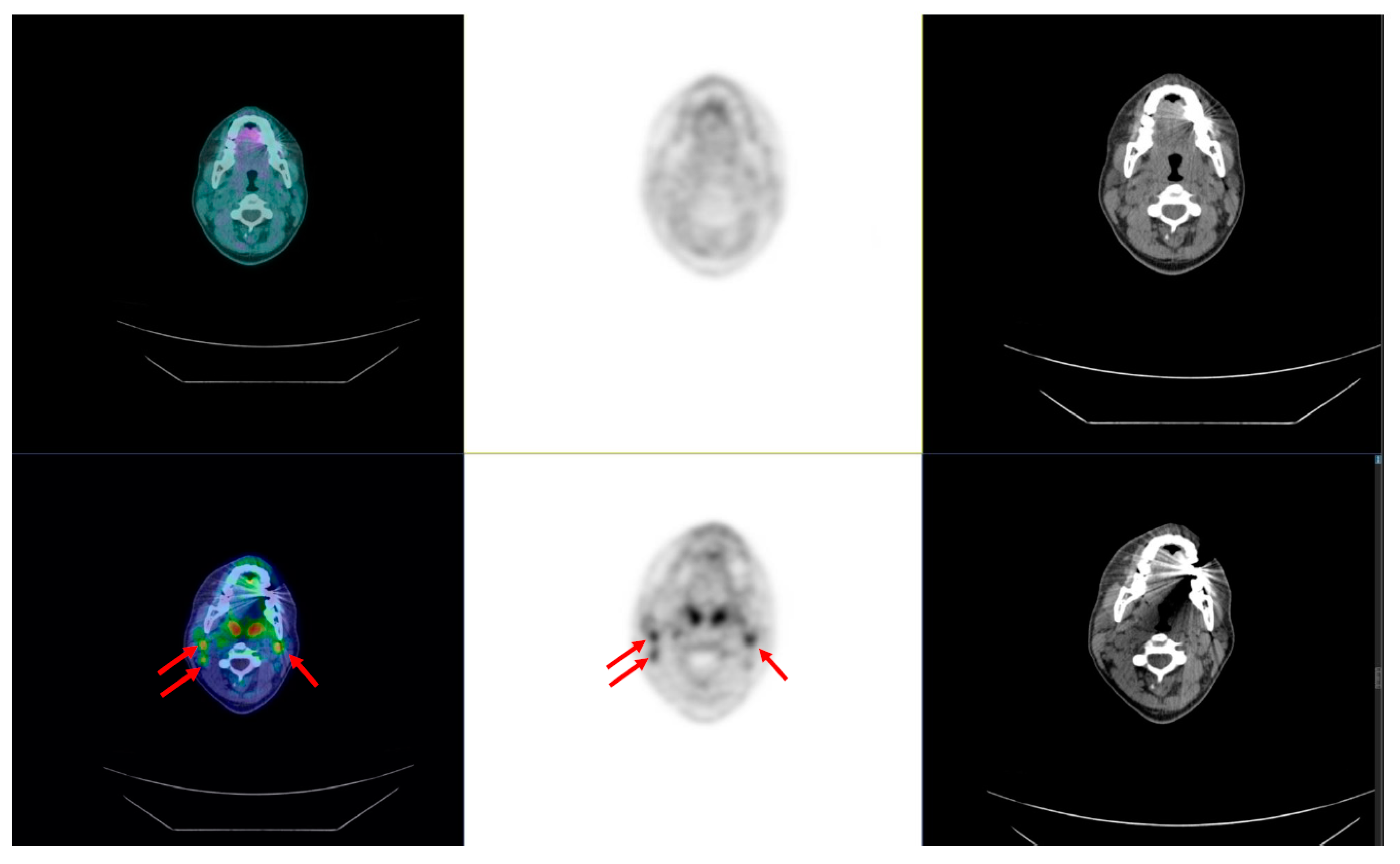 Cancers 14 01272 g008