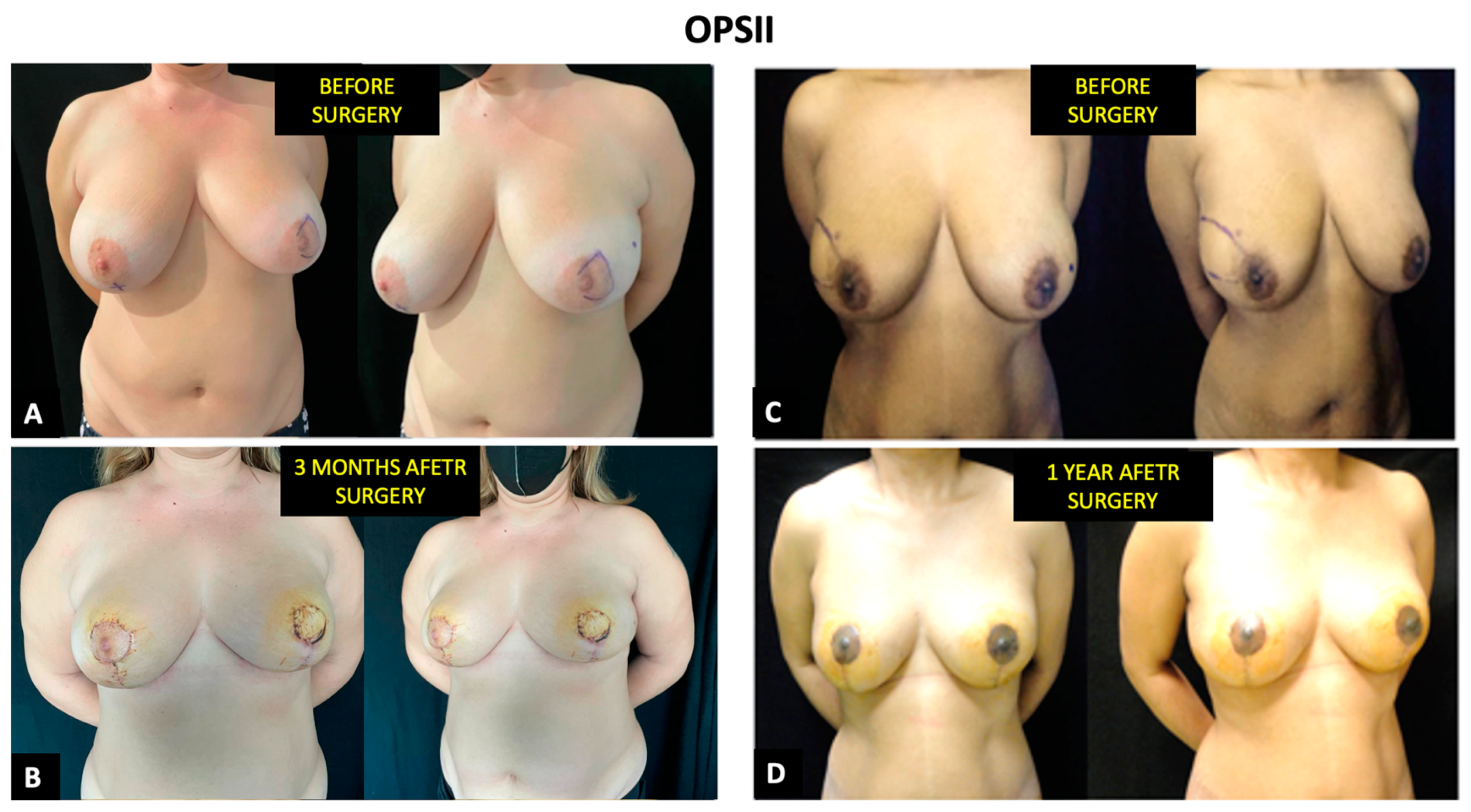 Cancers 14 01275 g006