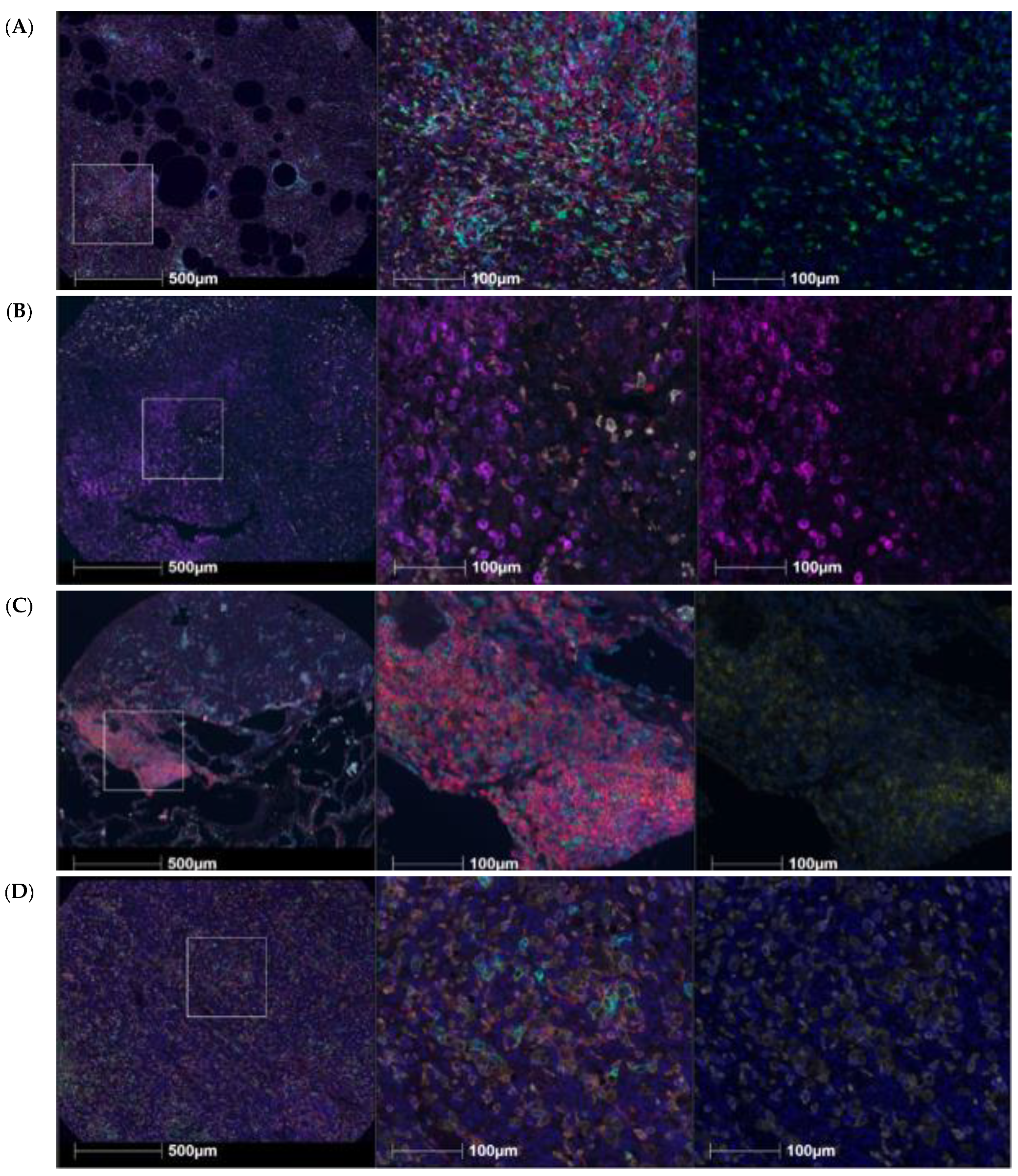 Cancers 14 01290 g002