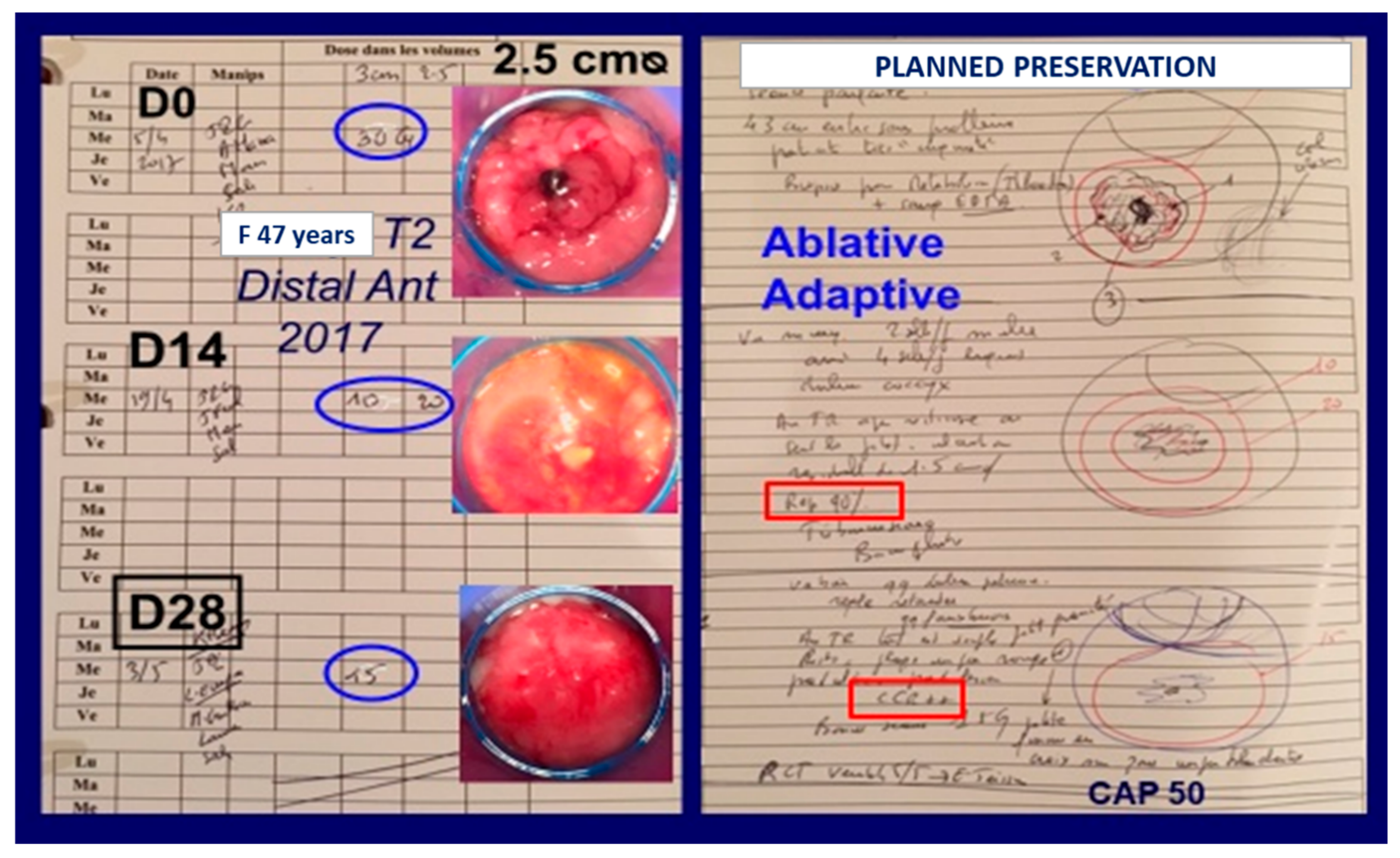 Cancers 14 01313 g002 550