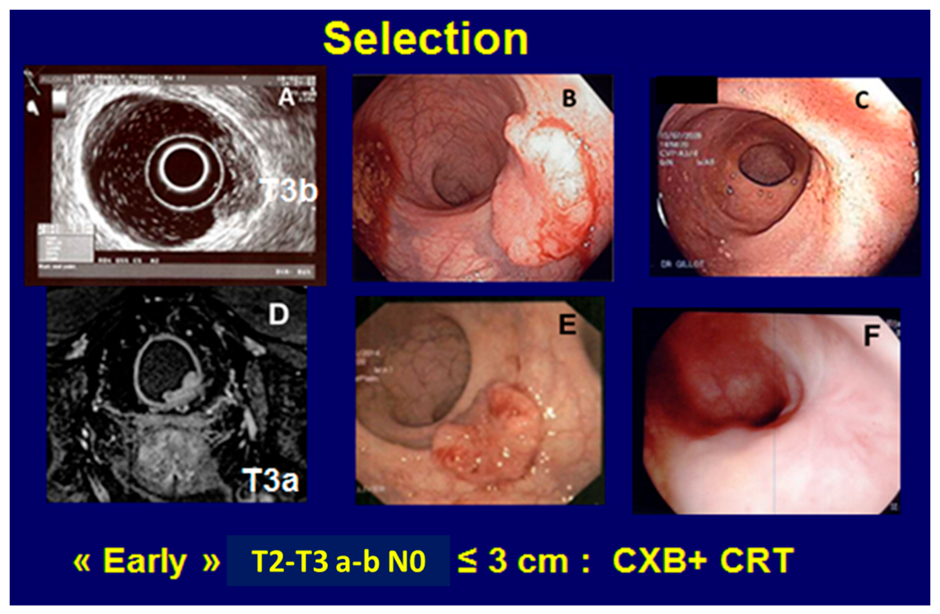 Cancers 14 01313 g003 550