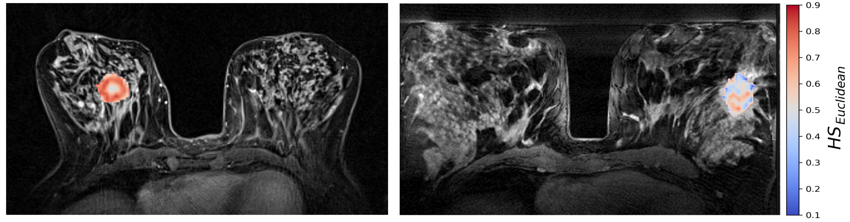 Cancers 14 01326 g005