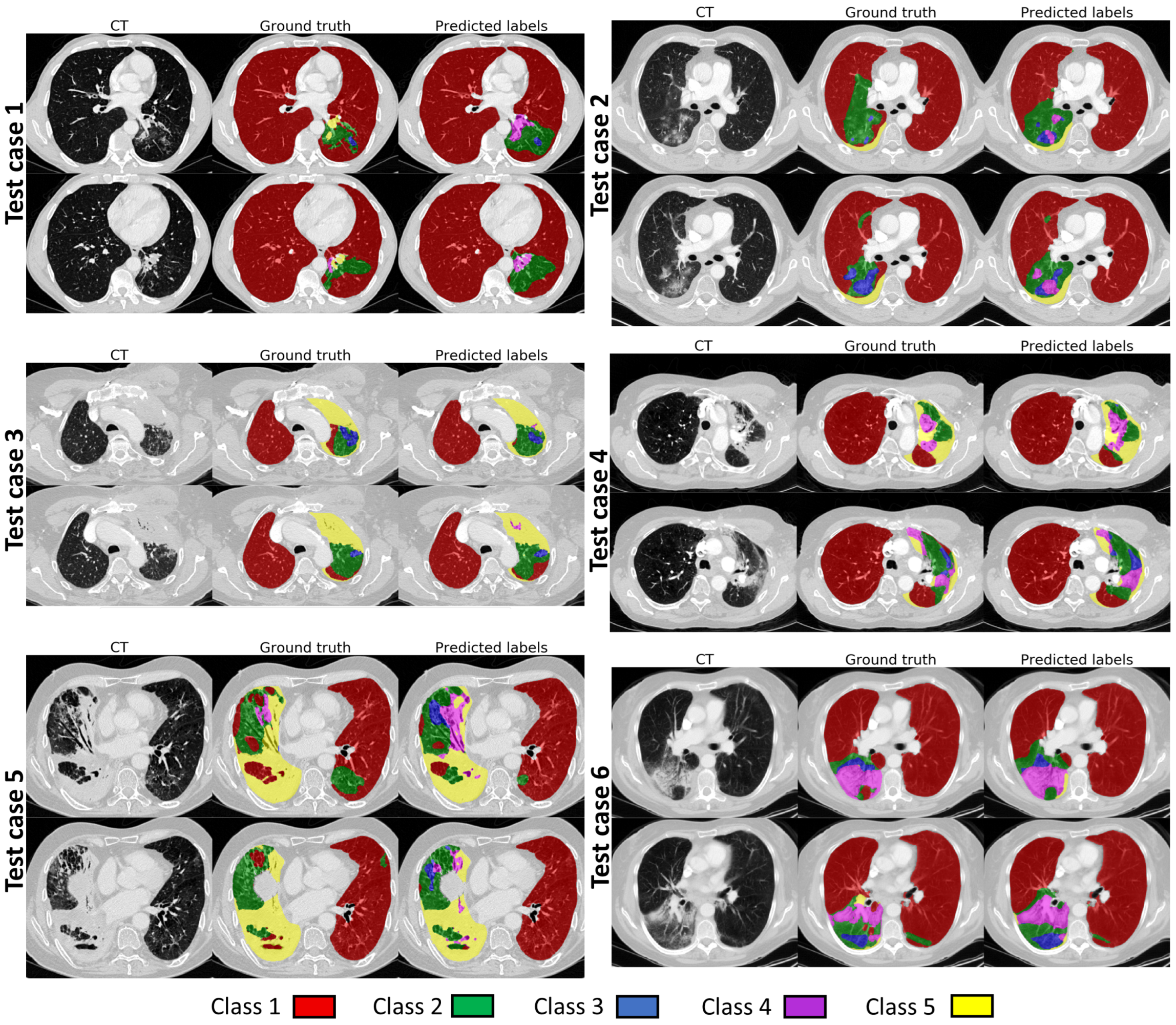 Cancers 14 01341 g005 550