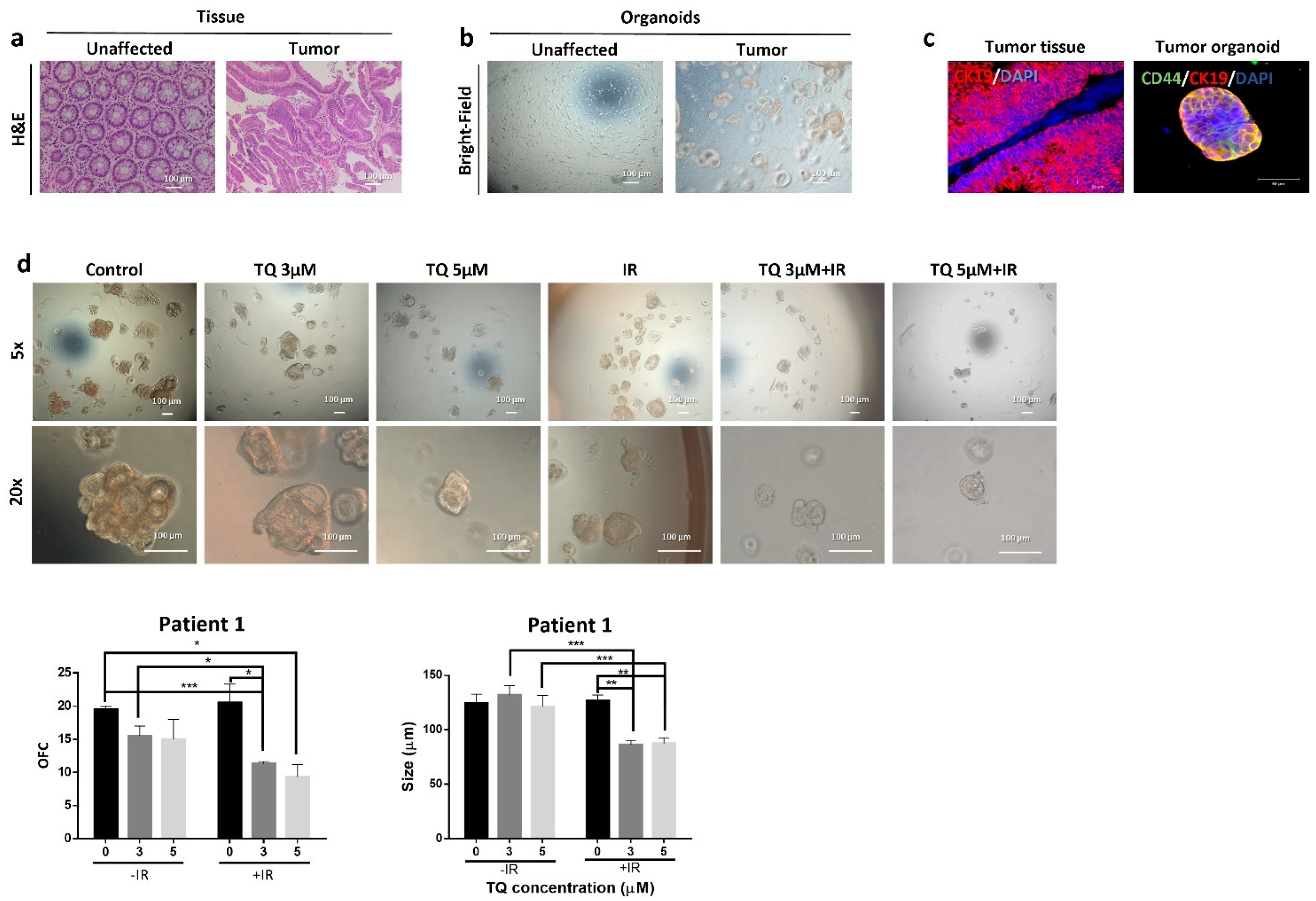 Cancers 14 01363 g006